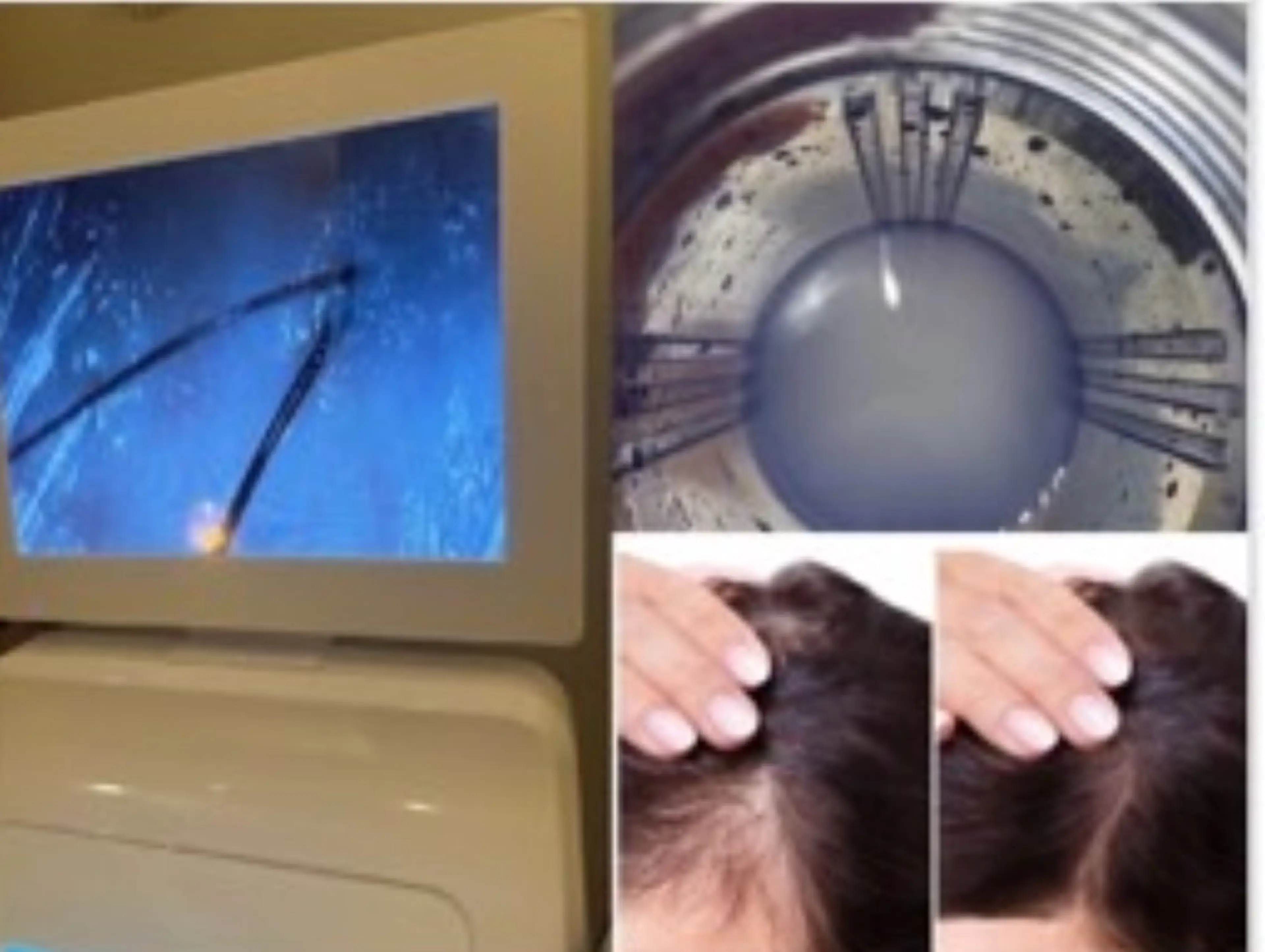 ヘッドスパ ponopipi 内堀の眉毛・アイブロウイメージ