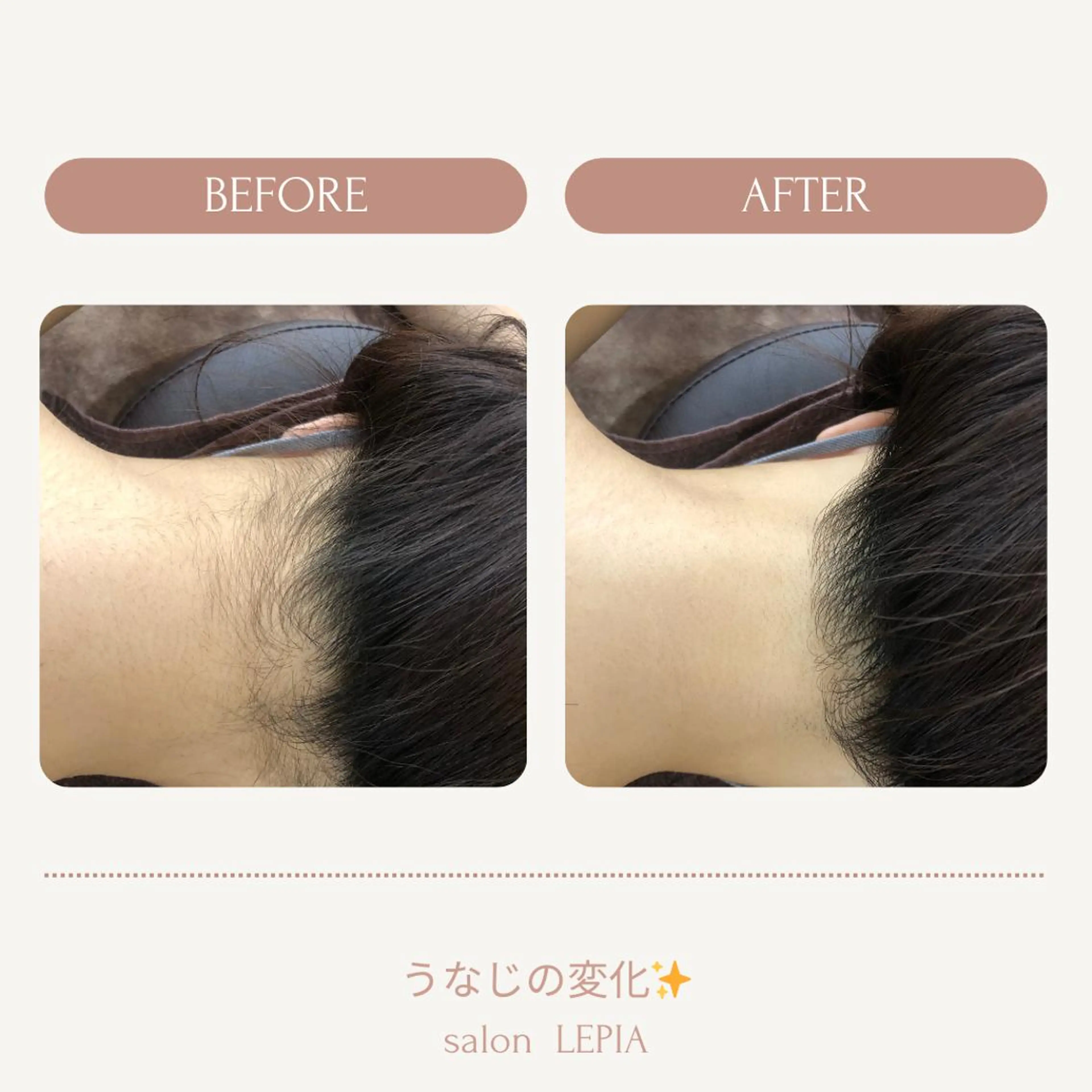 20代から始める脱毛 salonLEPIAのエステ・リラクイメージ