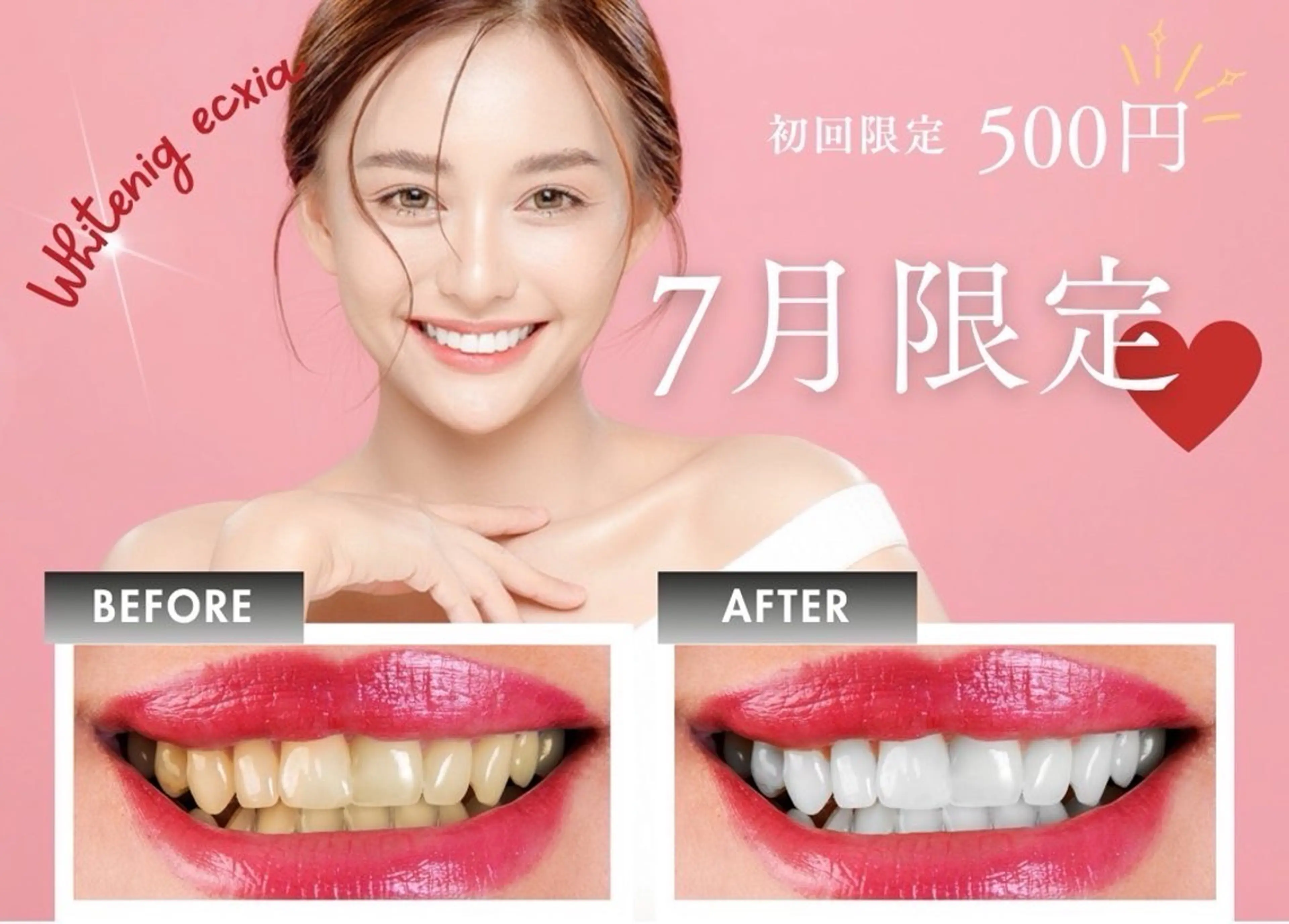 【🌸7月限定🌸】セルフホワイトニング¥3980→¥500の写真