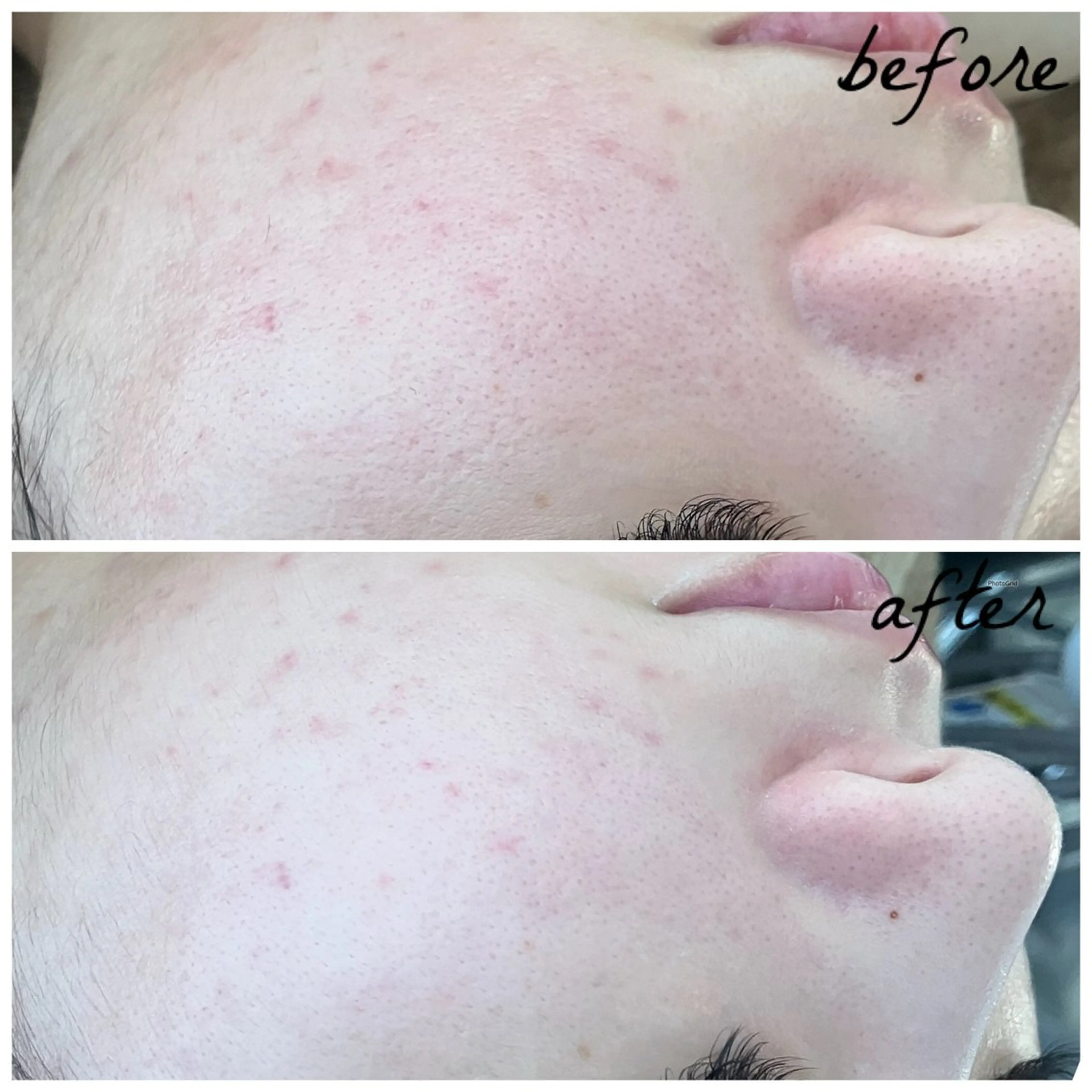 メンズ エステ メナード岐阜茜部 杉浦のエステ・リラクイメージ