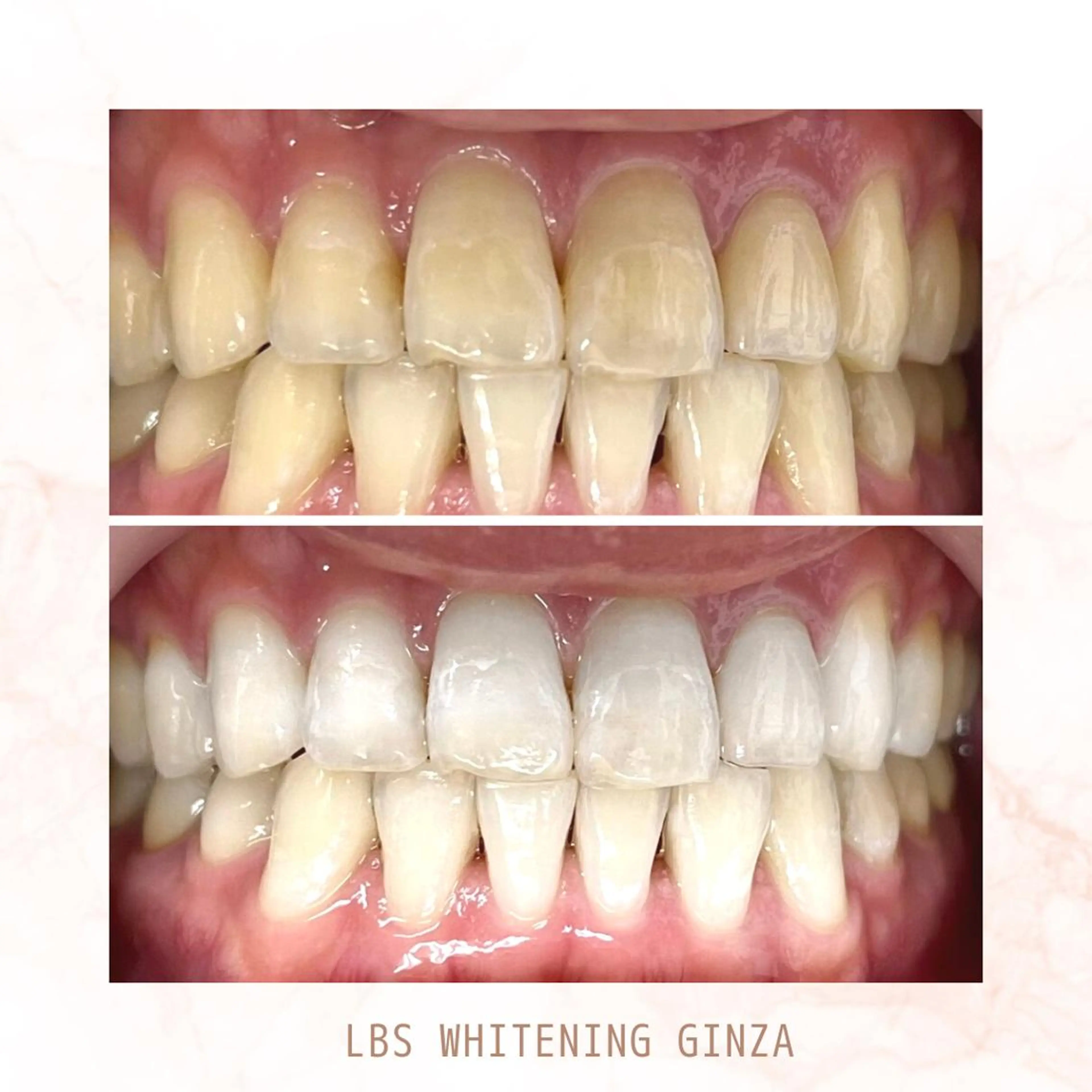 メンズ エステ リラク LBSホワイトニング 銀座店💎店長浦和のその他イメージ