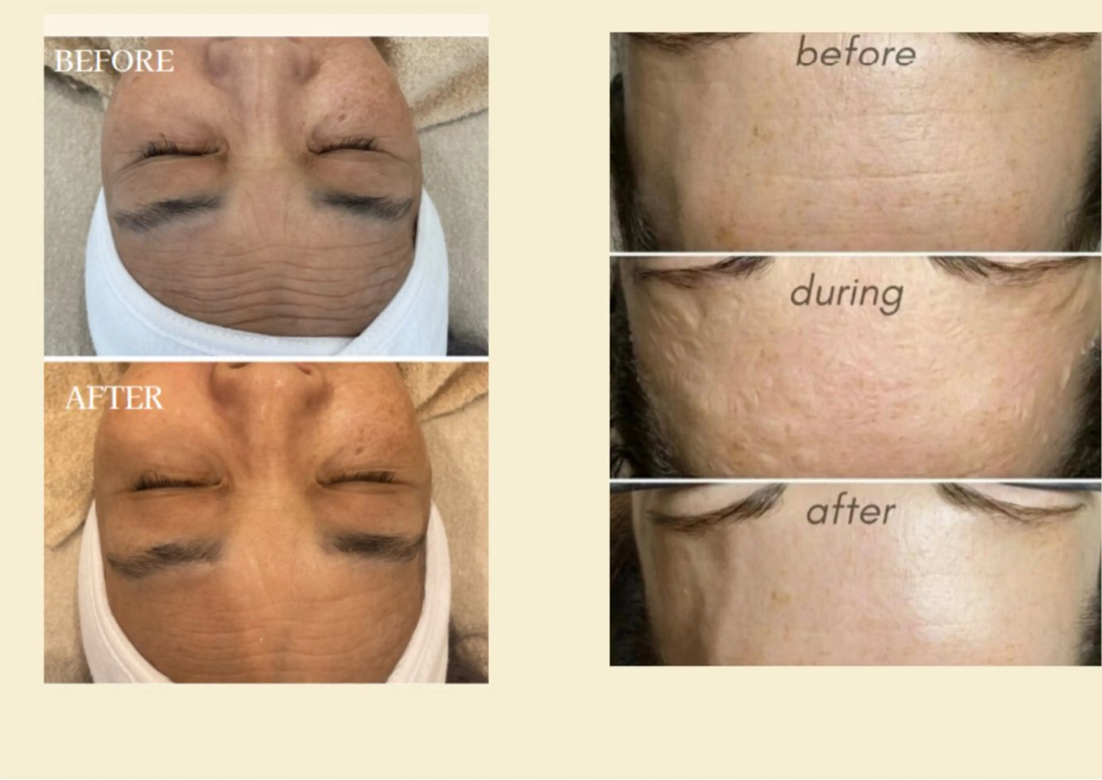 エステ 艶肌ワックス ALLY.のエステ・リラクイメージ