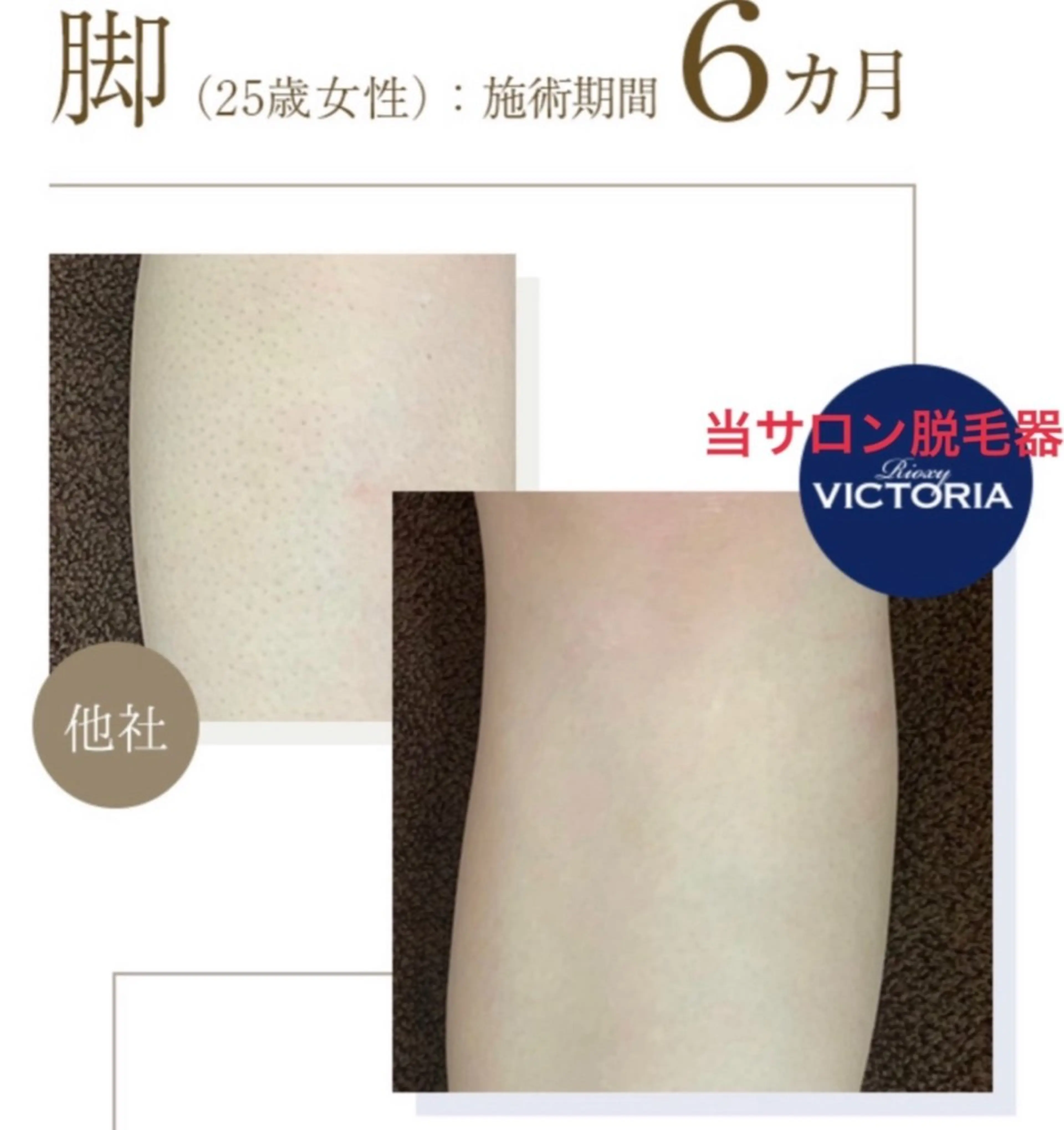脱毛 M's Style NAIL BARのエステ・リラクイメージ