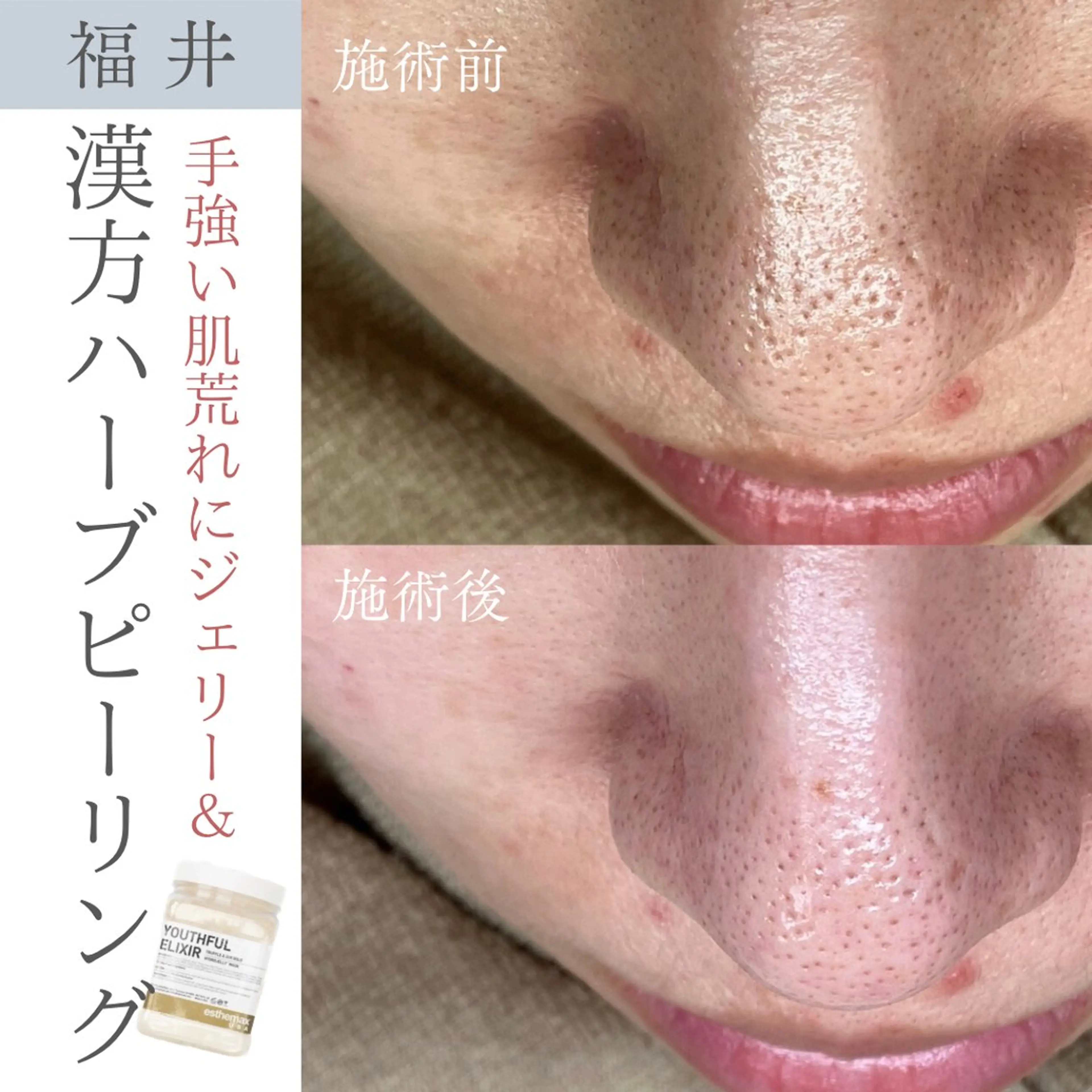 毛穴ケア専門サロン Yourmeユアミーのエステ・リラクイメージ