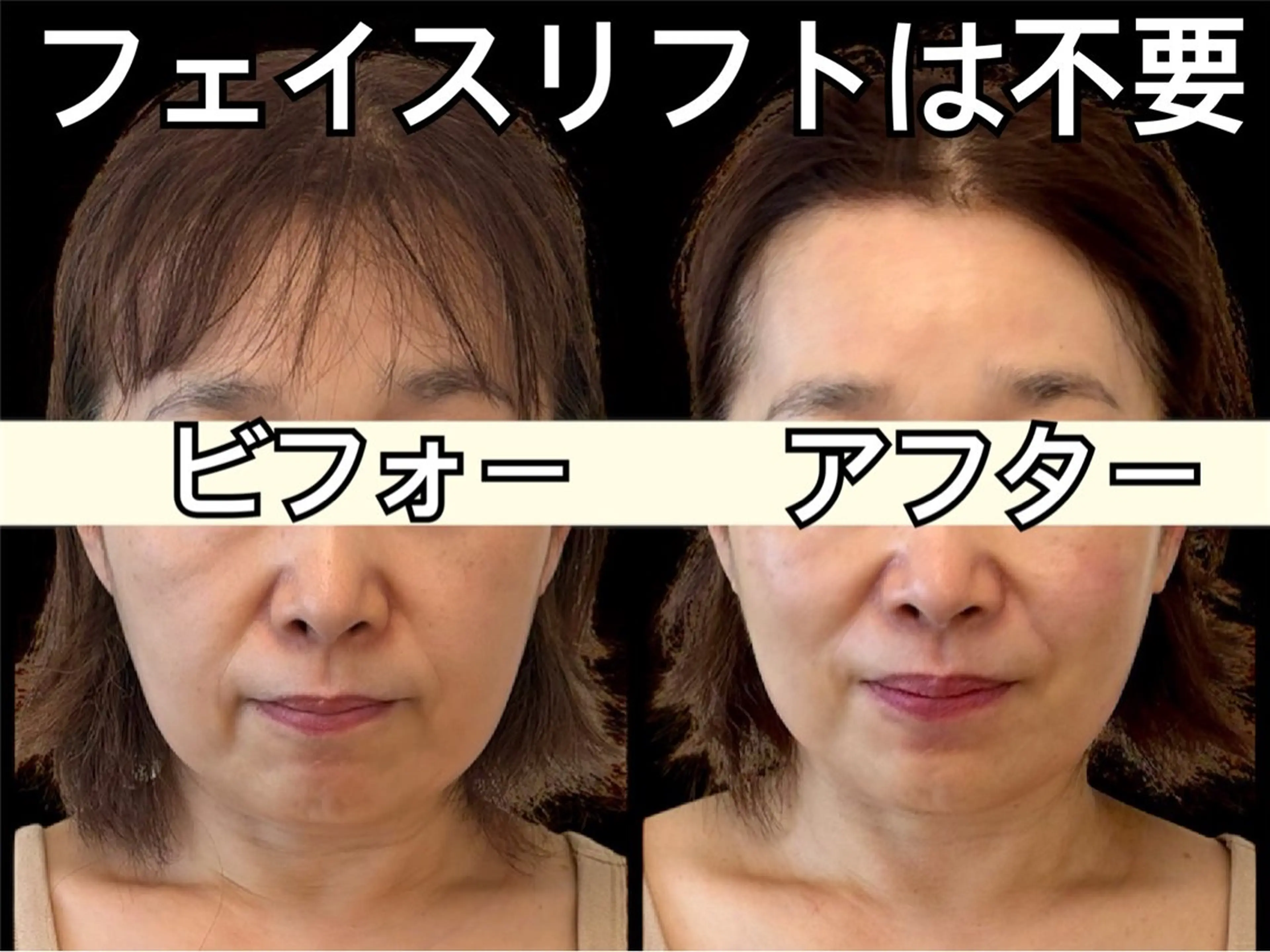 小顔専門看護師クリニカルサロンCOCO所属・ローマピンクと小顔 クリニカルサロンココのエステ・リラクイメージ