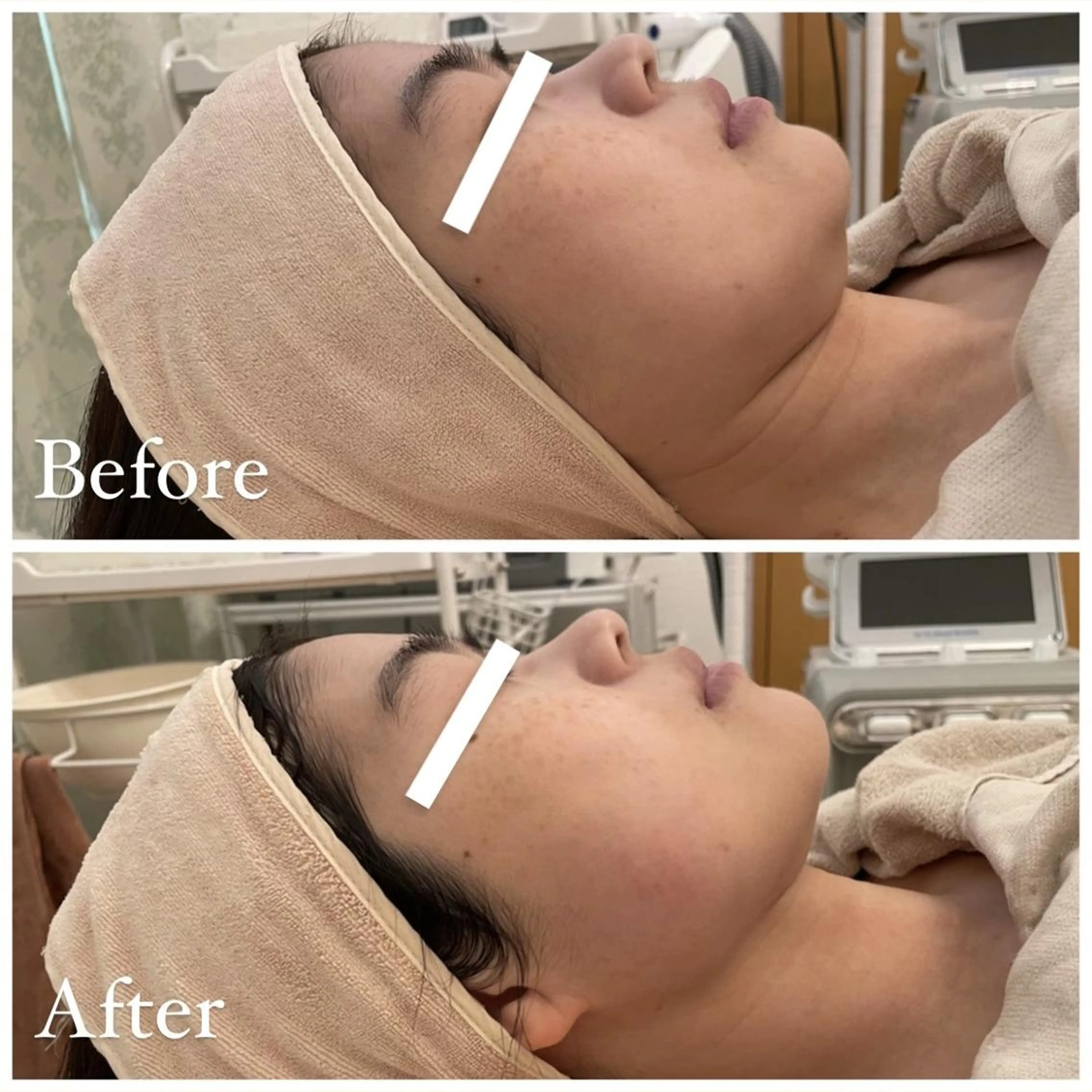 ✨美肌水光✨ アトリエリュバンのエステ・リラクイメージ