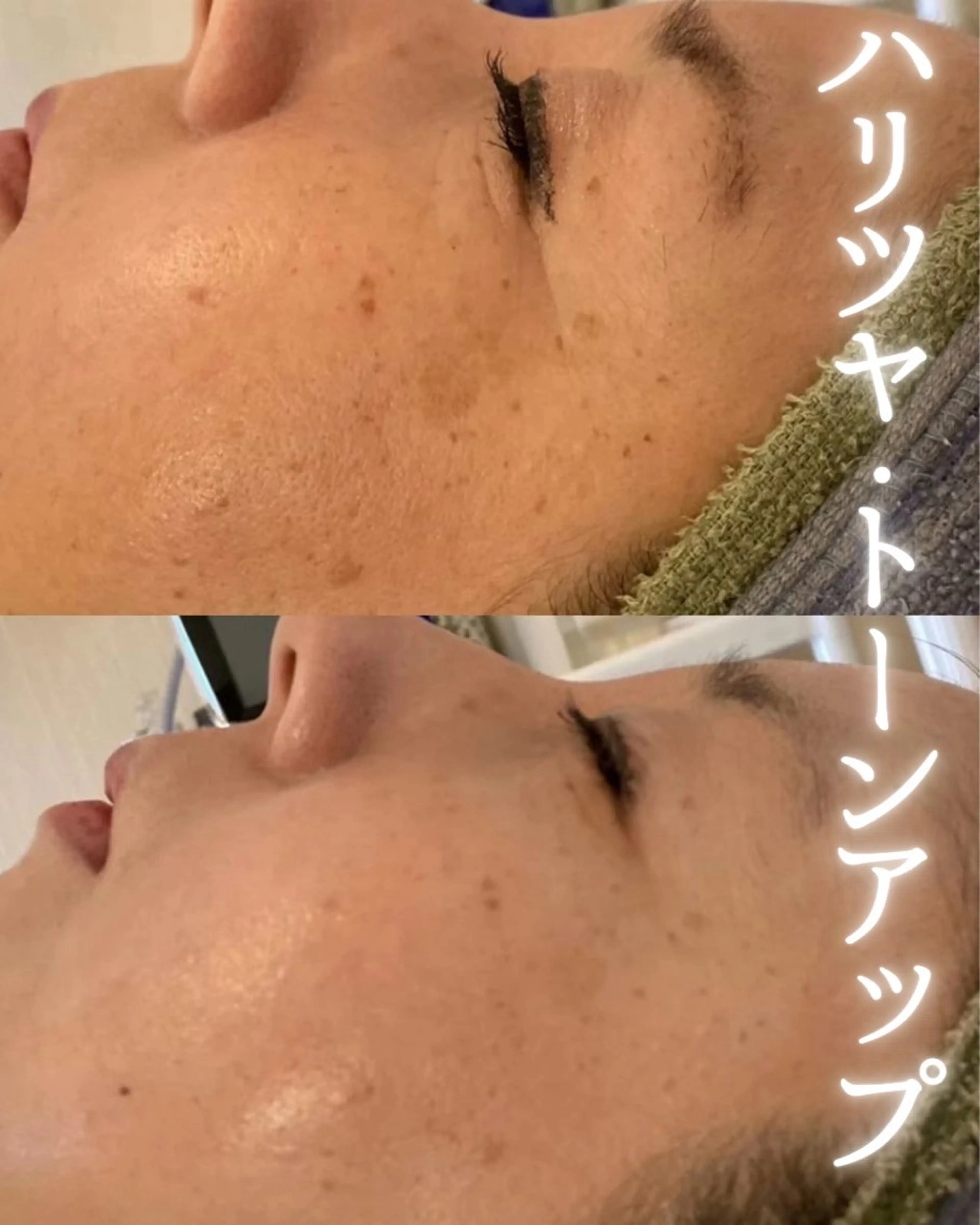 private beauty salon Lilby所属・リルビー 肌質改善・肌育サロンのエステ・リラクイメージ