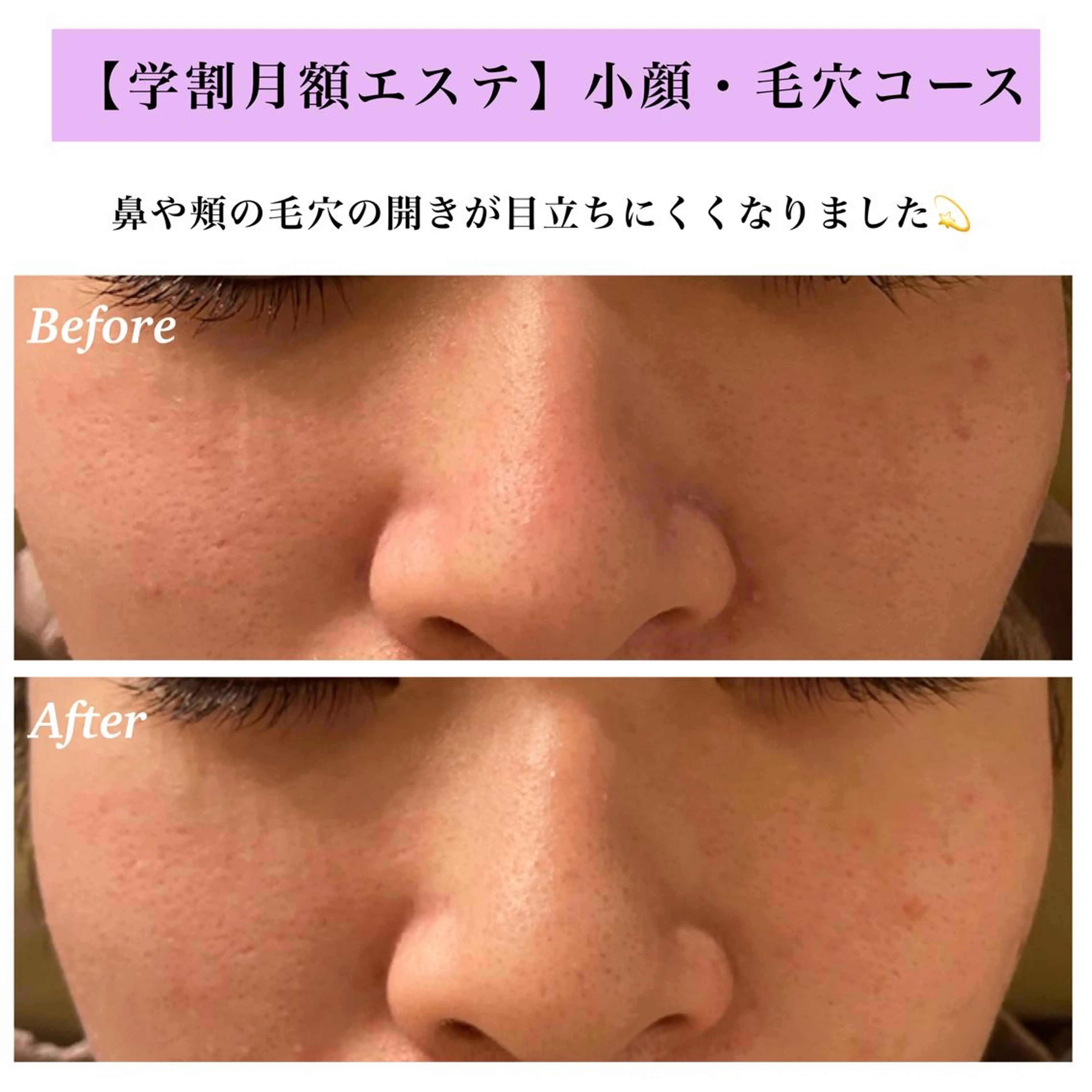 Bellesthe (ベルエステ)のエステ・リラクイメージ