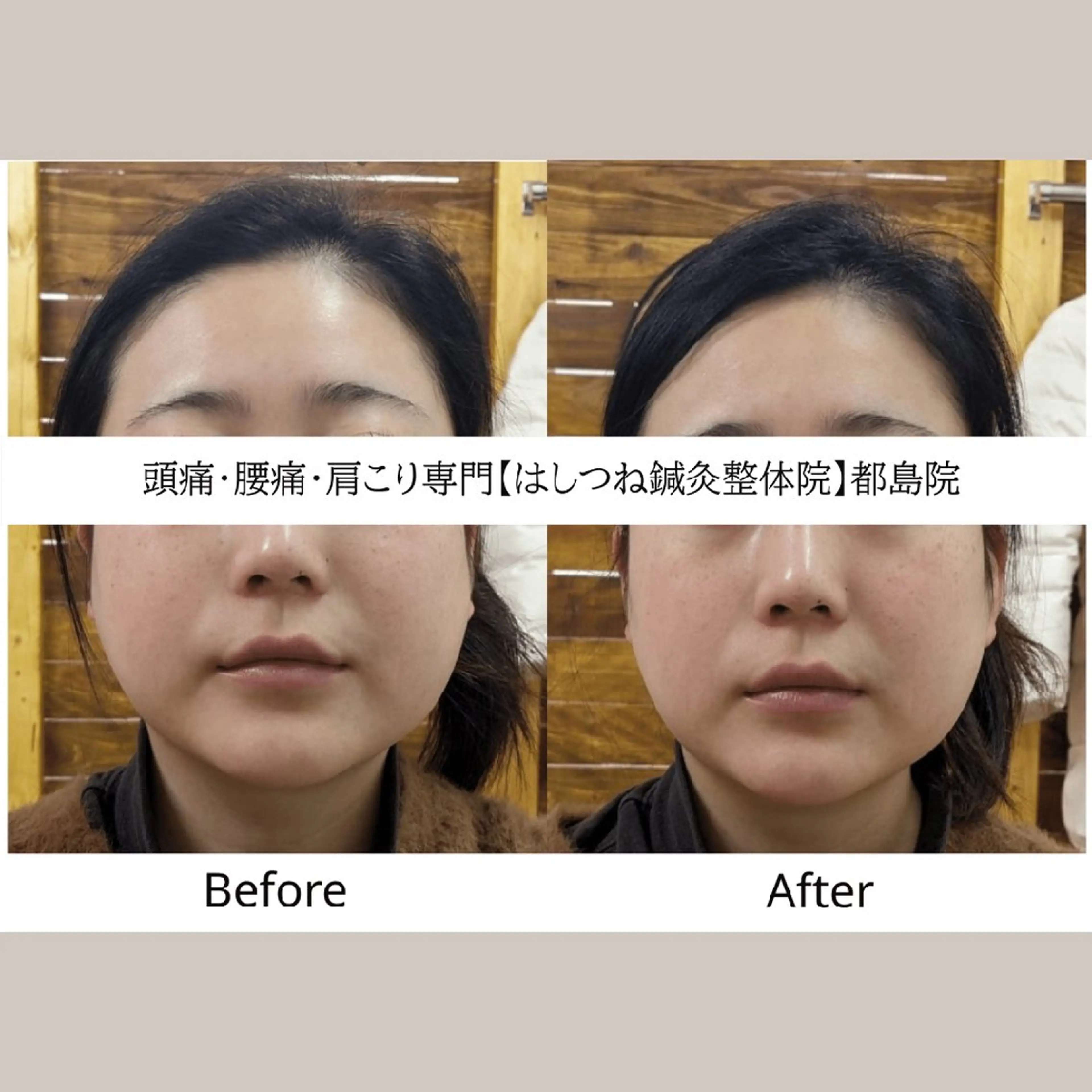 エステ リラク 頭痛・腰痛・美容鍼に 特化してます。　橋岡のエステ・リラクイメージ