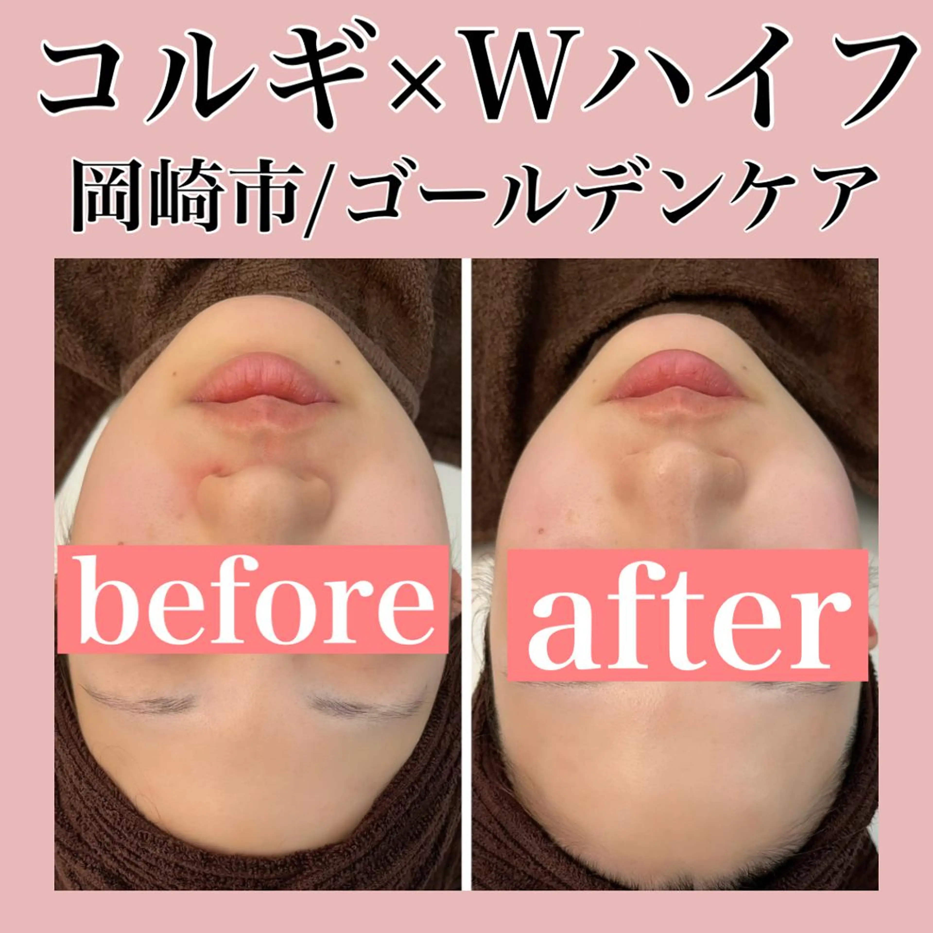 ■超絶小顔＆肌管理室■所属・🦋整形級の究極美顔 本格韓国式小顔🦋のエステ・リラクイメージ