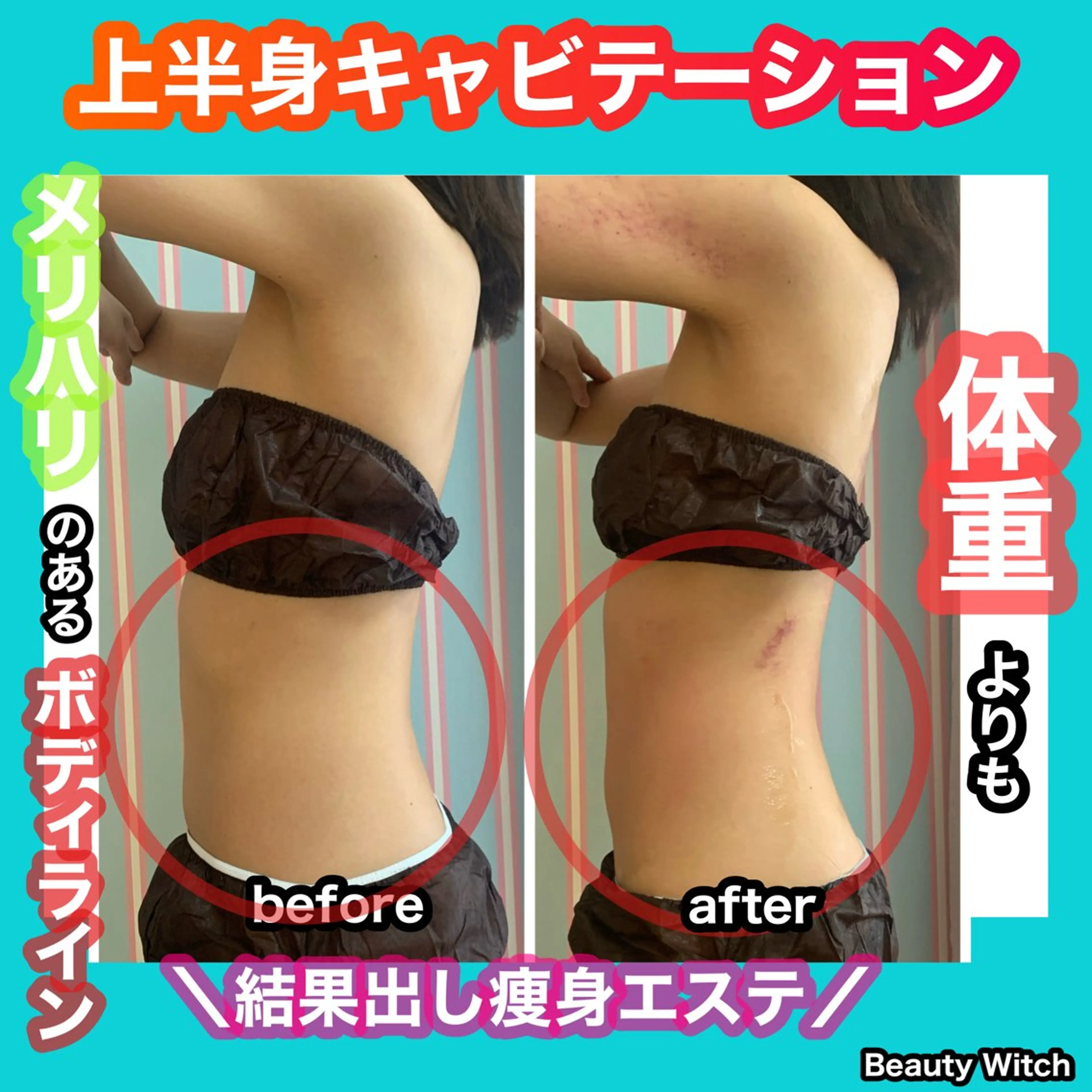 エステ リラク 痩身/脱毛/ネイル HARUKAのエステ・リラクイメージ