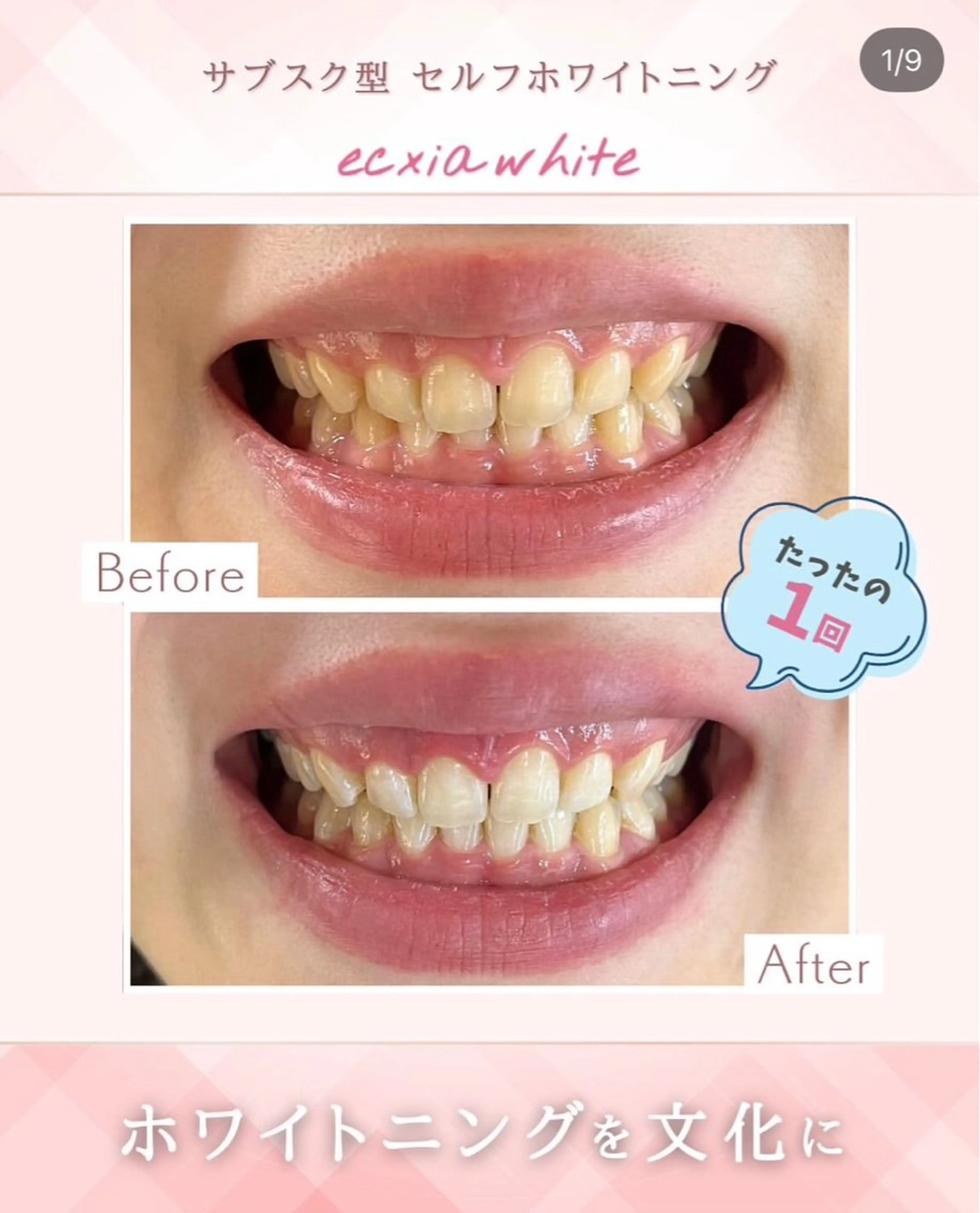 エステ エクシアホワイト 立川南口のエステ・リラクイメージ