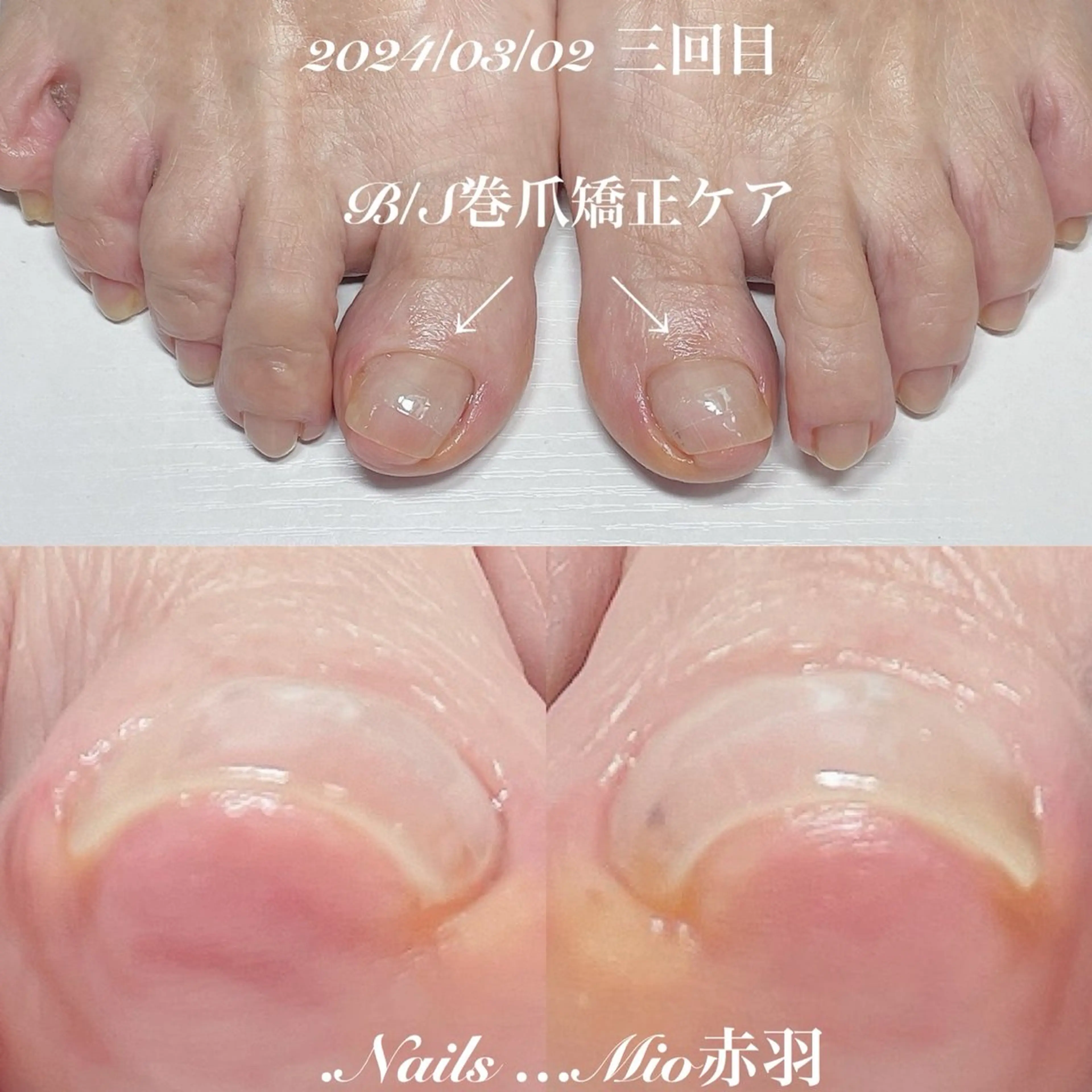 ネイル フットネイル 赤色 .Nails Mio 赤羽西ネイルサロンのネイルデザイン