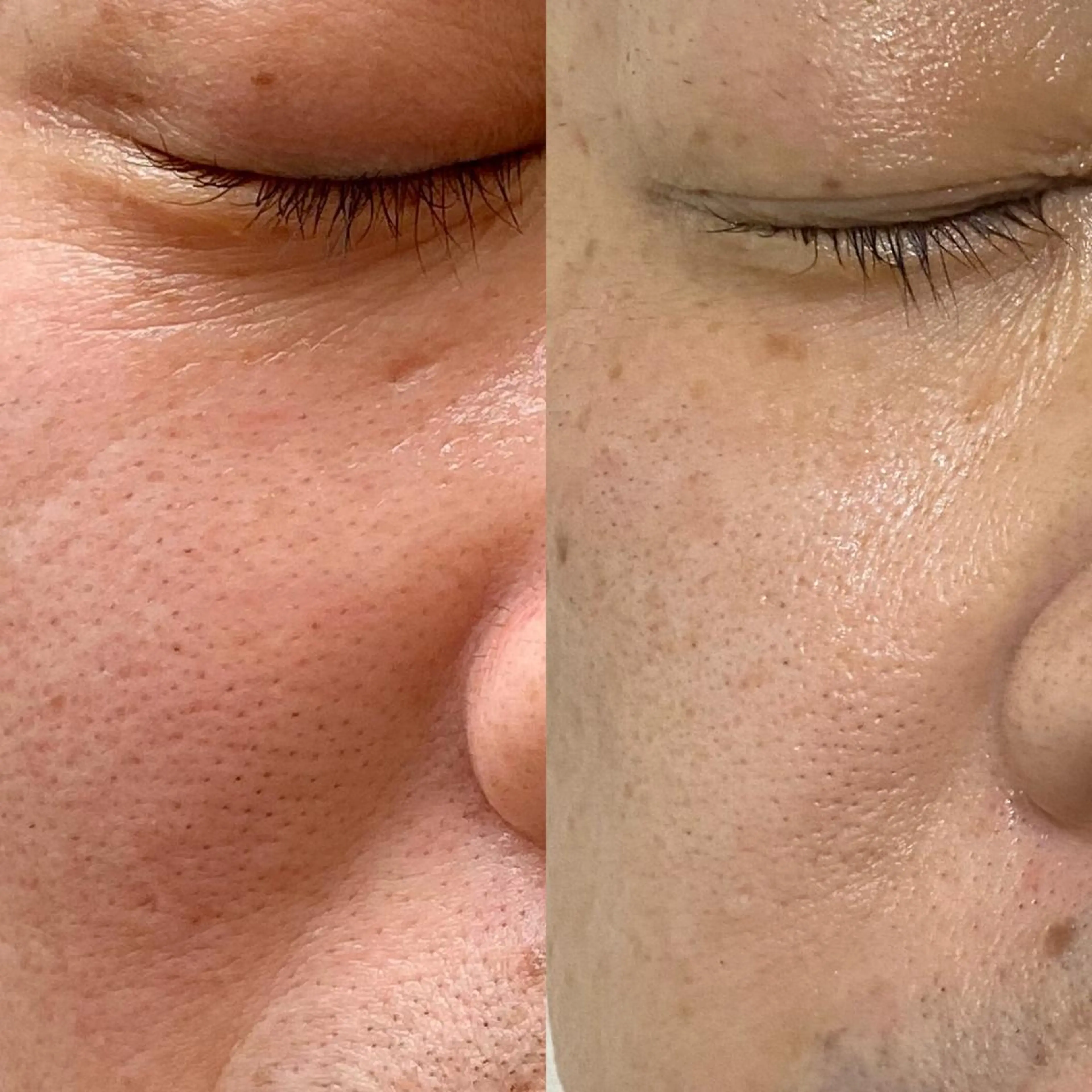 Meetite 小林のエステ・リラクイメージ