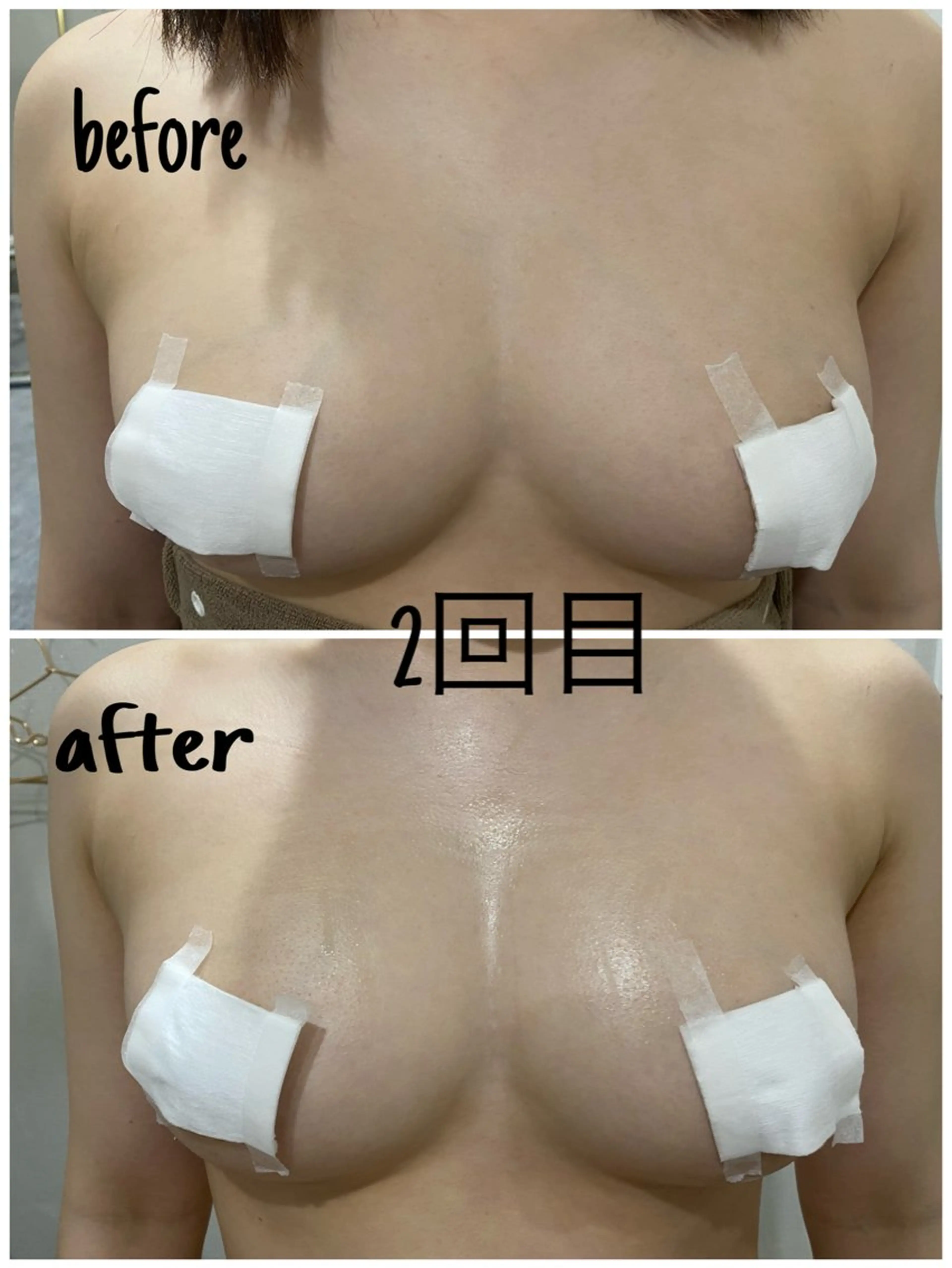 エステ 毛穴洗浄・痩身・脱毛 /アルカンジュのエステ・リラクイメージ