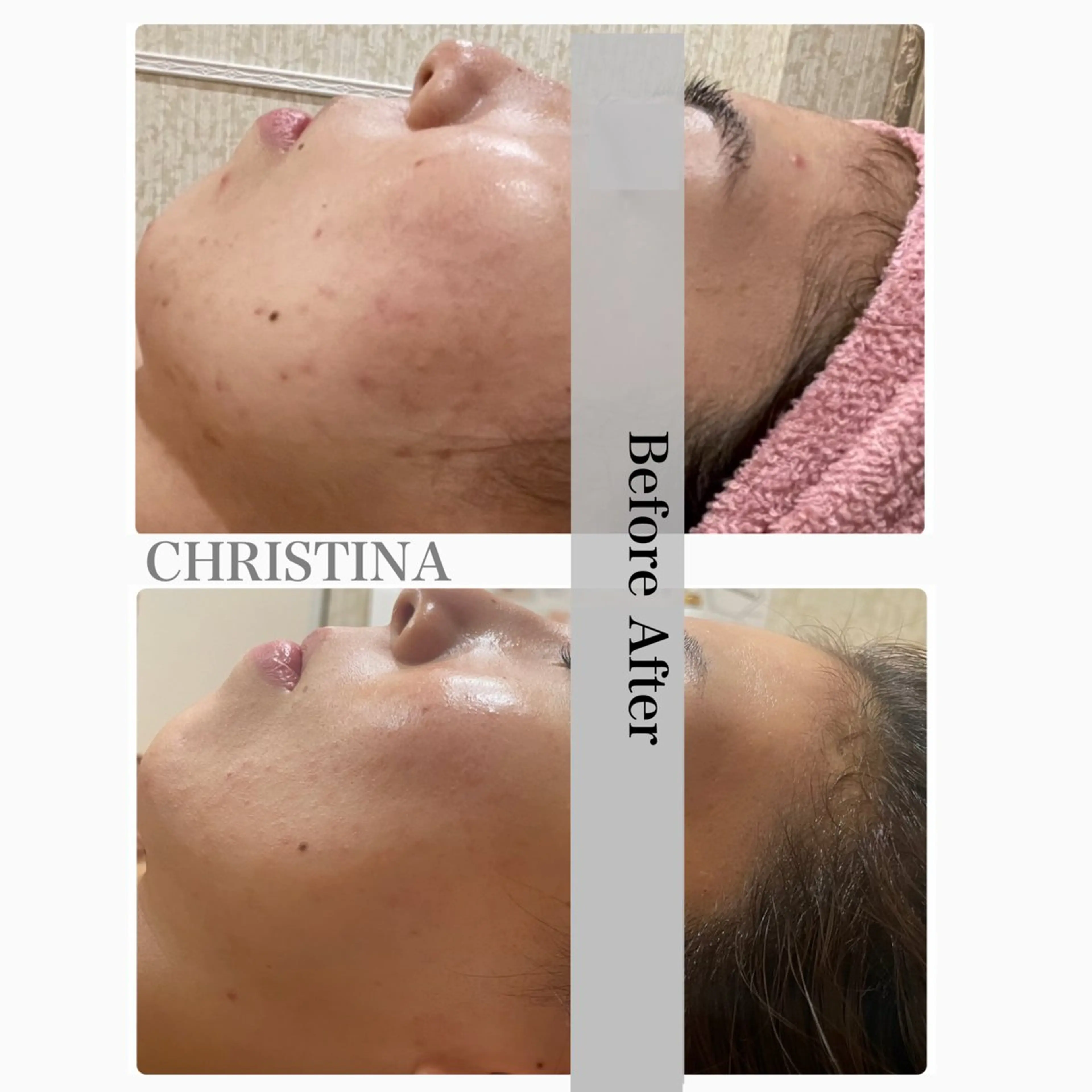 エステ矢野 ジョアアンジェ心斎橋のエステ・リラクイメージ