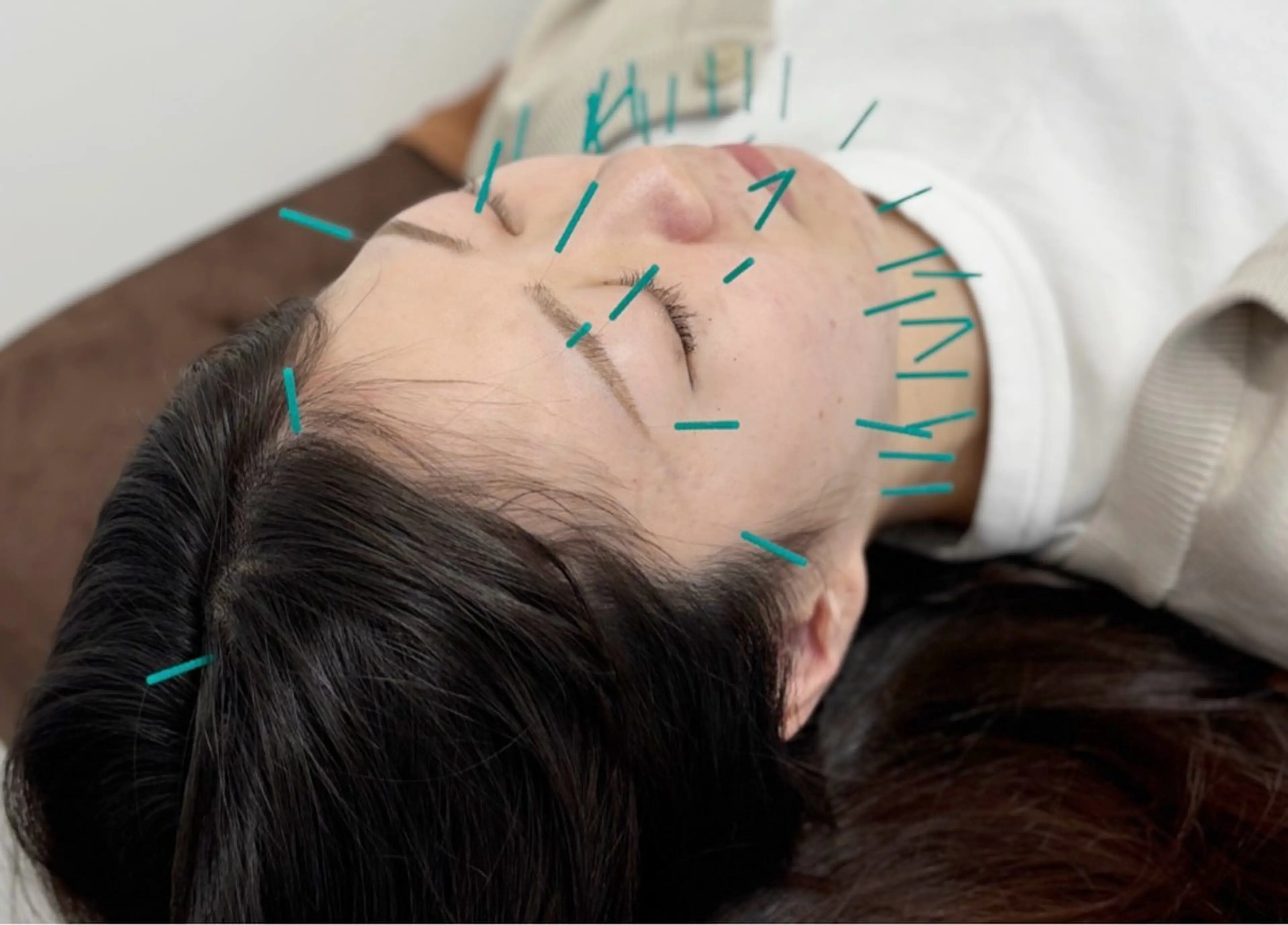 ミディアム カラー エステ リラク 内田 整骨院のエステ・リラクイメージ