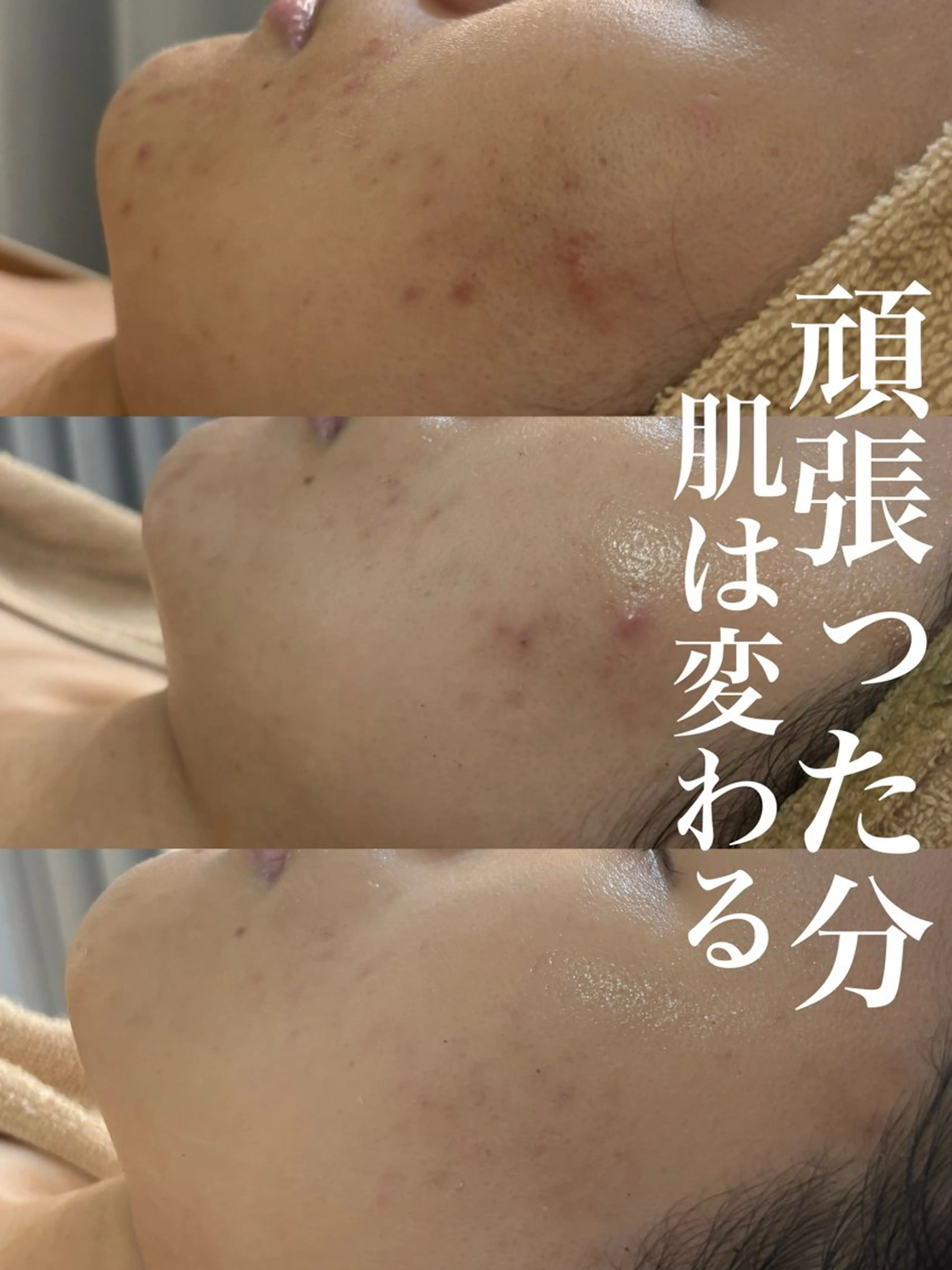 エステ WHITE AQUA 北千住店のエステ・リラクイメージ