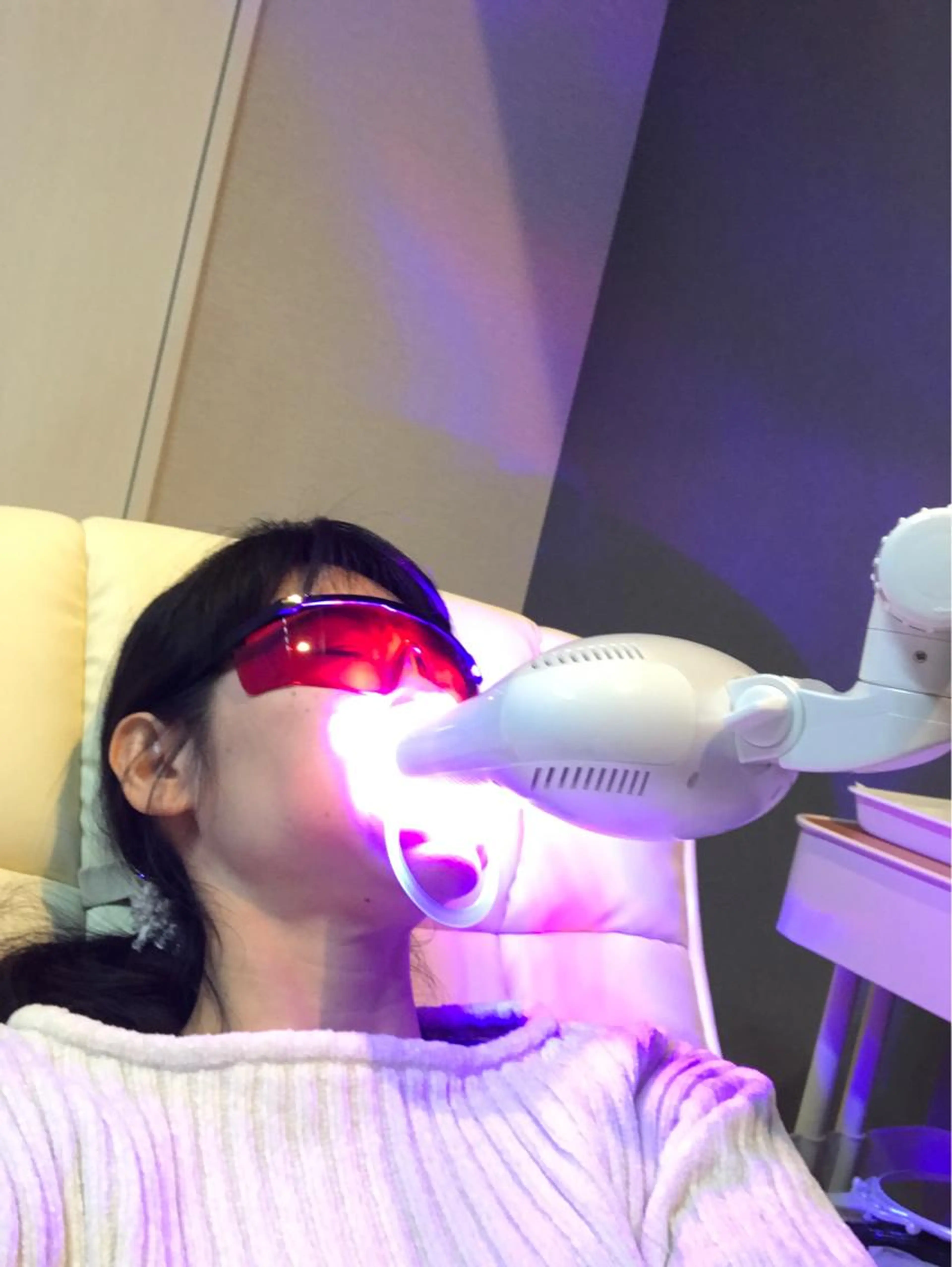 歯のセルフホワイトニング初回の写真