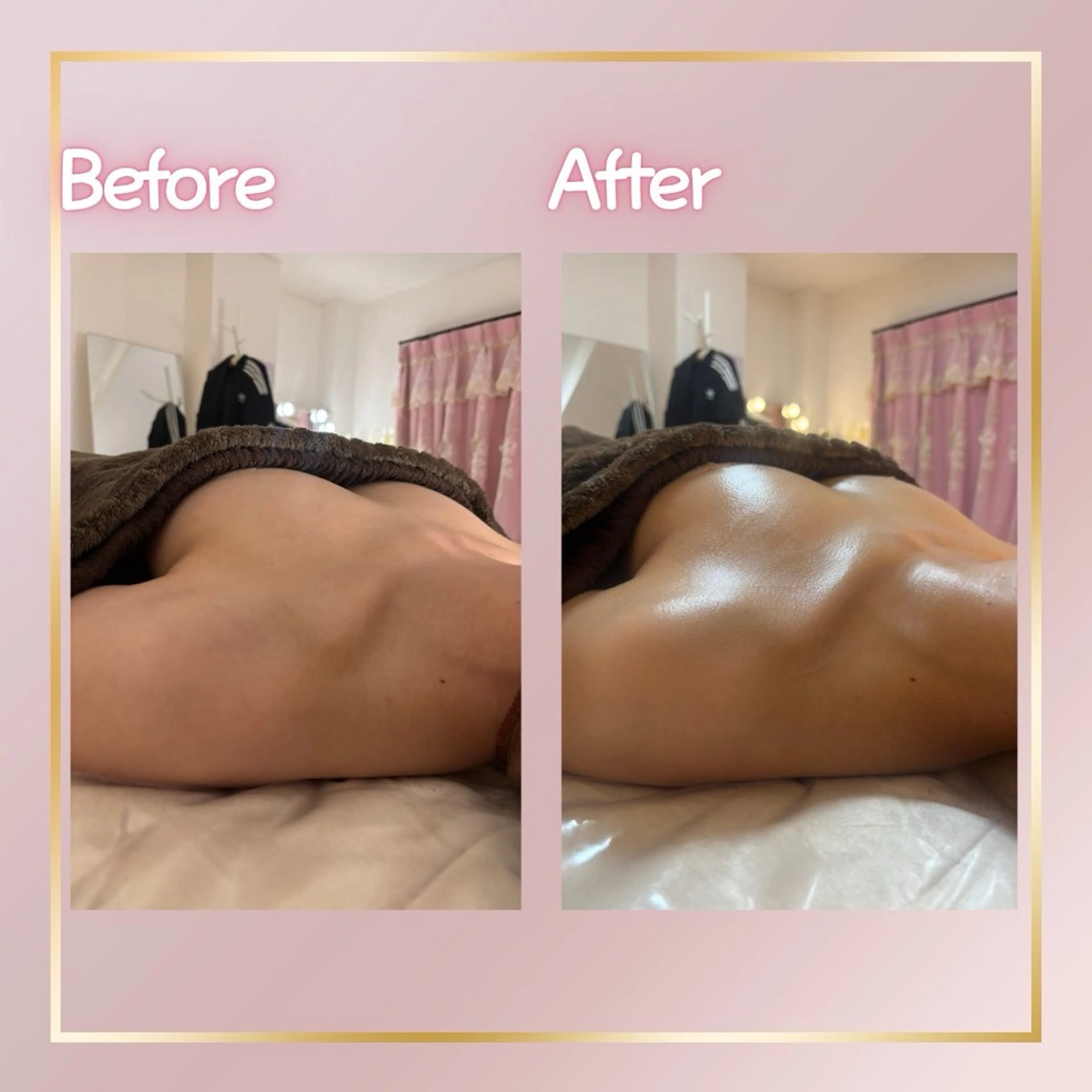 エステ ROSALIA 【バストアップ、痩身、毛穴洗浄】所属・ROSALIA バスト 小顔 毛穴のエステ・リラクイメージ