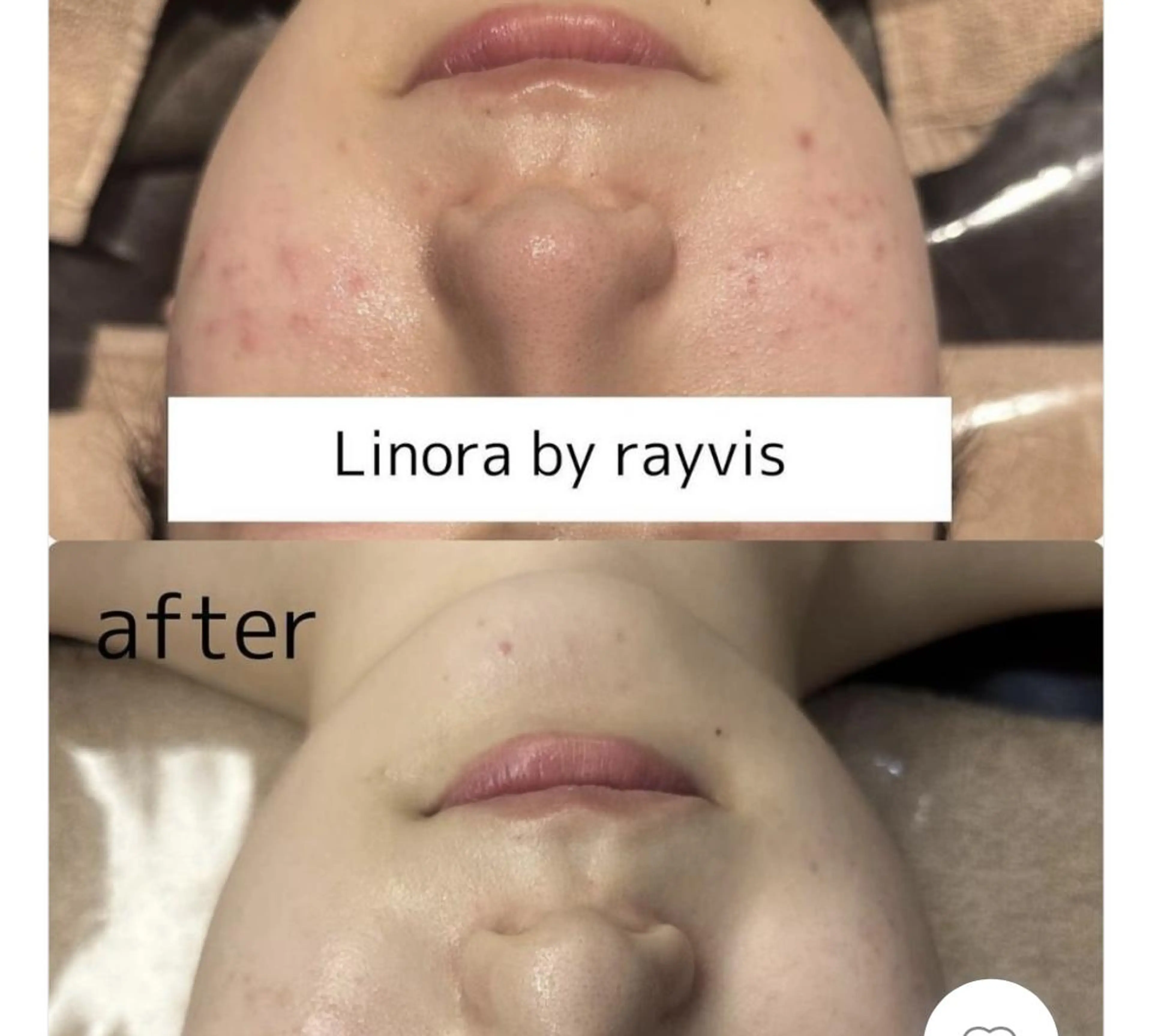エステ 🌈Linora byRAYVIS🌈のエステ・リラクイメージ