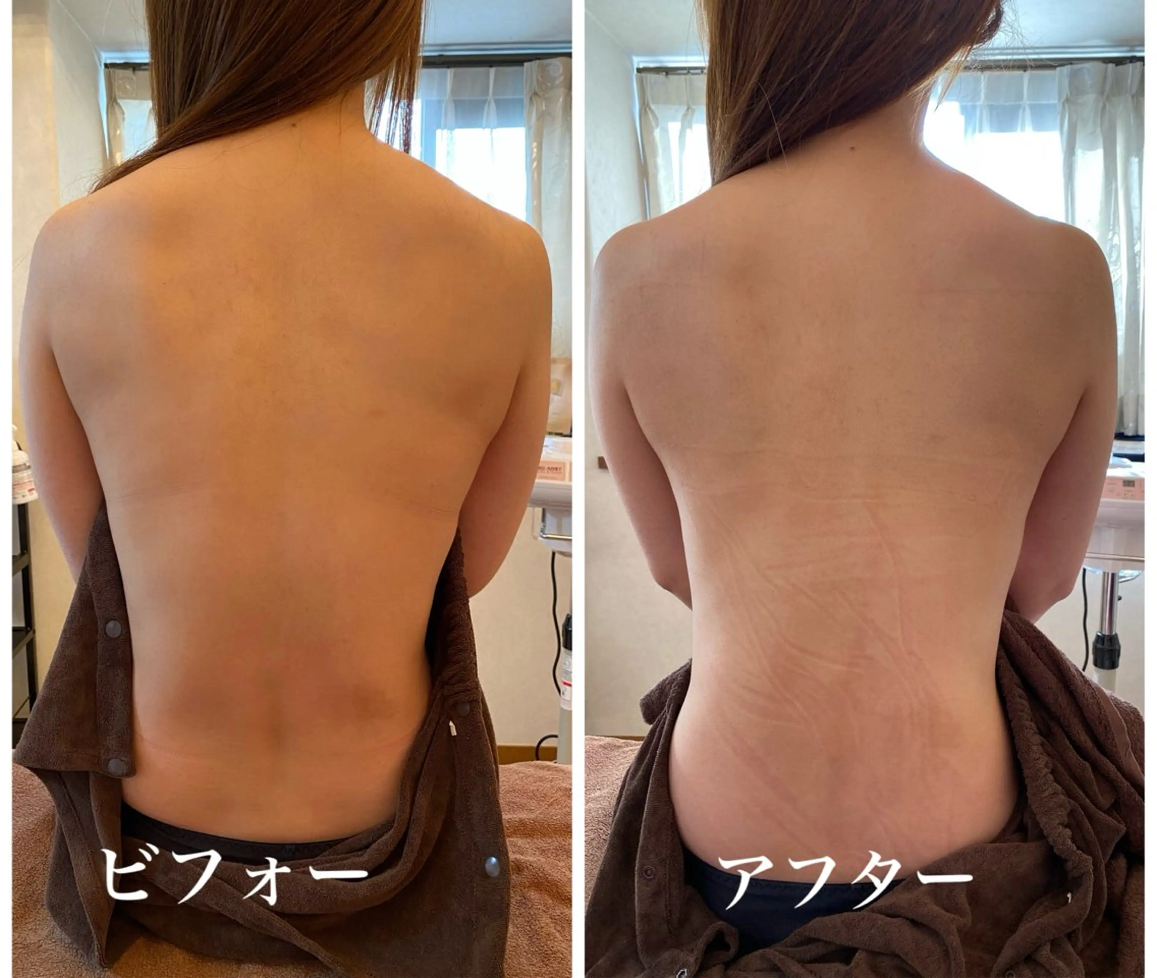 esther全身トリートメント⏰15時までのご予約限定価格の写真