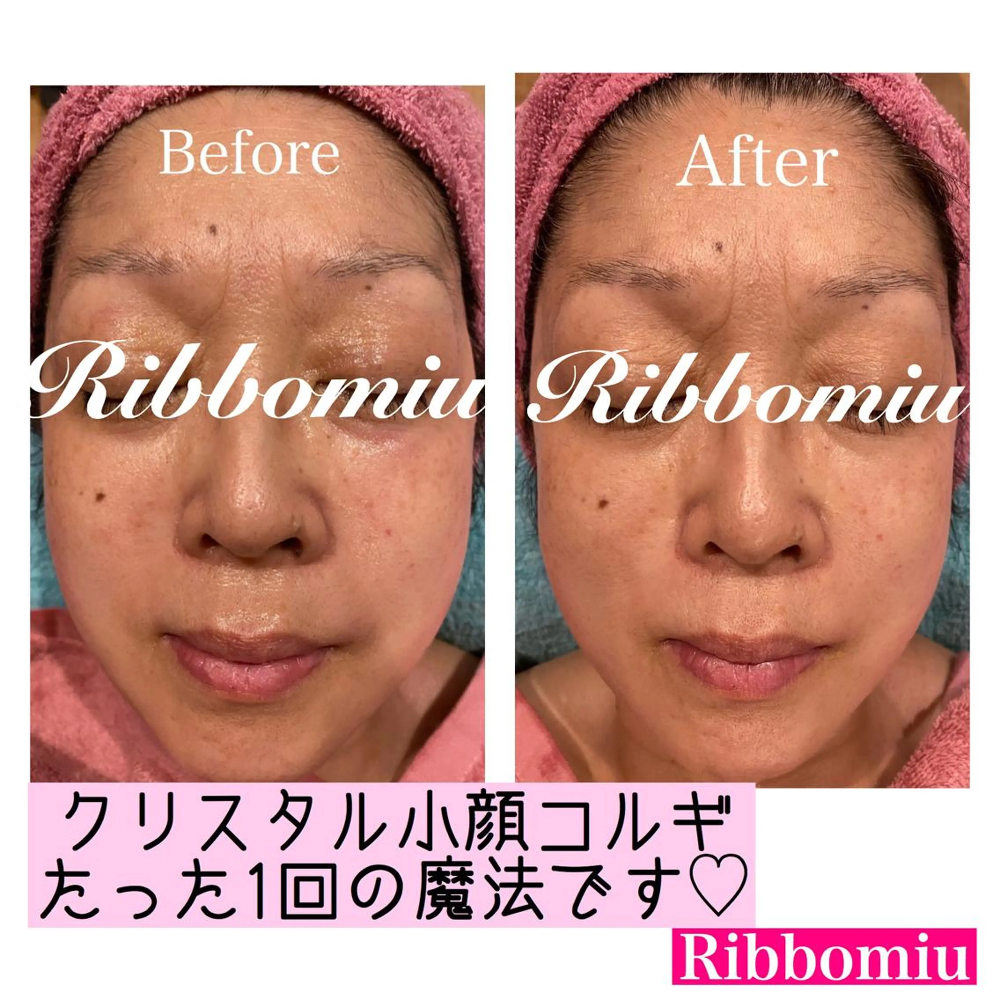 ♡Ribbomiu♡所属・バストアップ 専門Ribbomiuのエステ・リラクイメージ