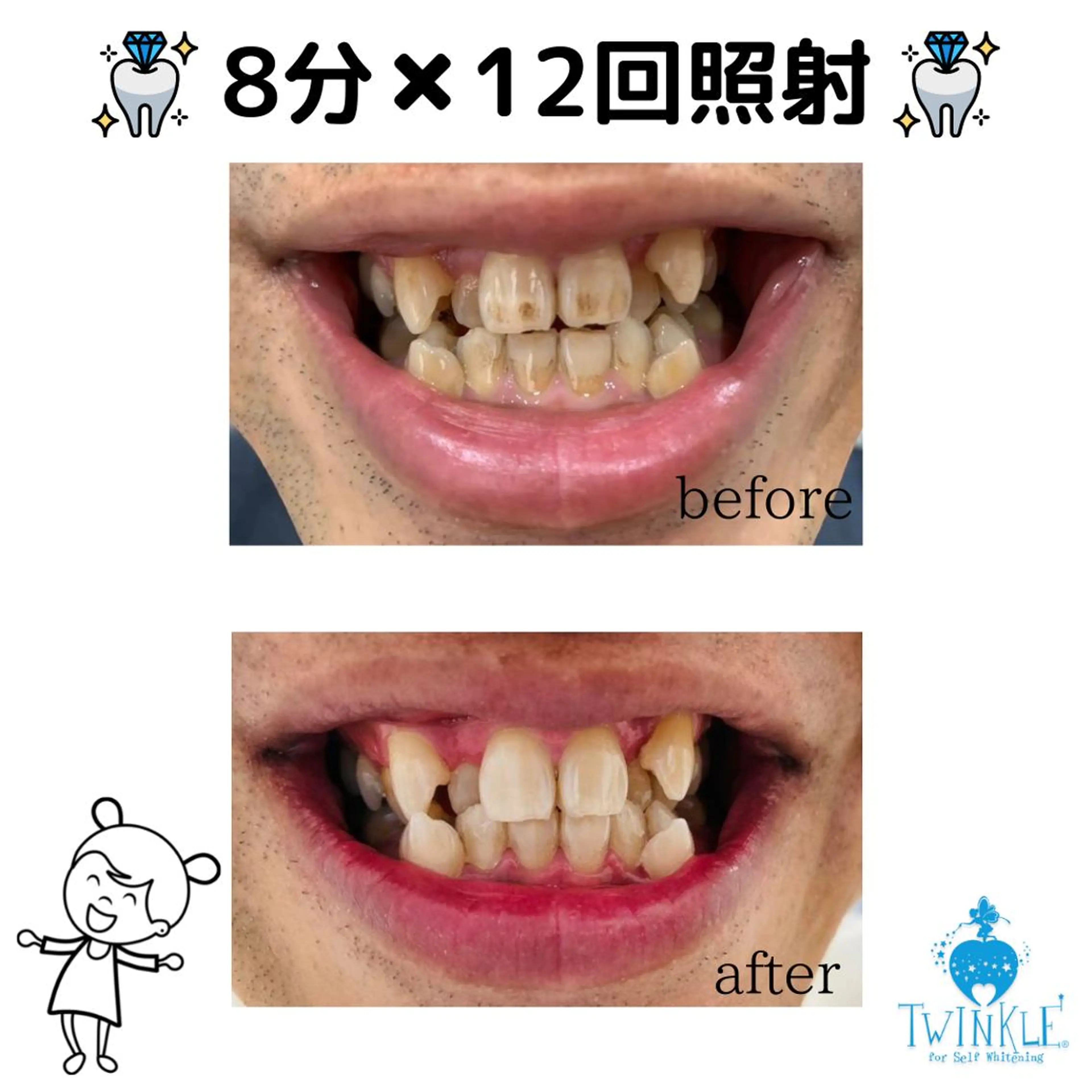 Twinkle White仙台店のエステ・リラクイメージ