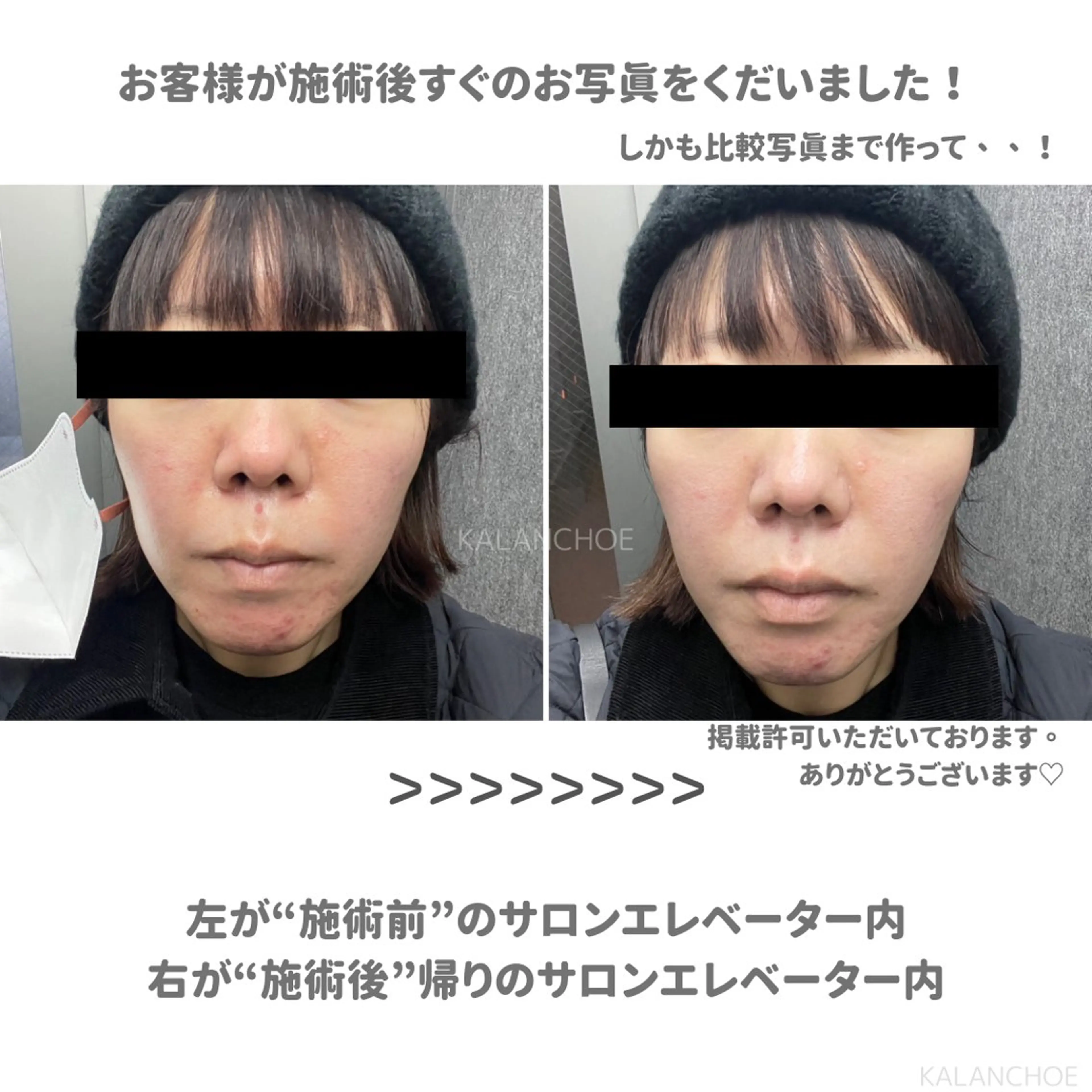 エステ 肌質改善 KALANCHOEのエステ・リラクイメージ