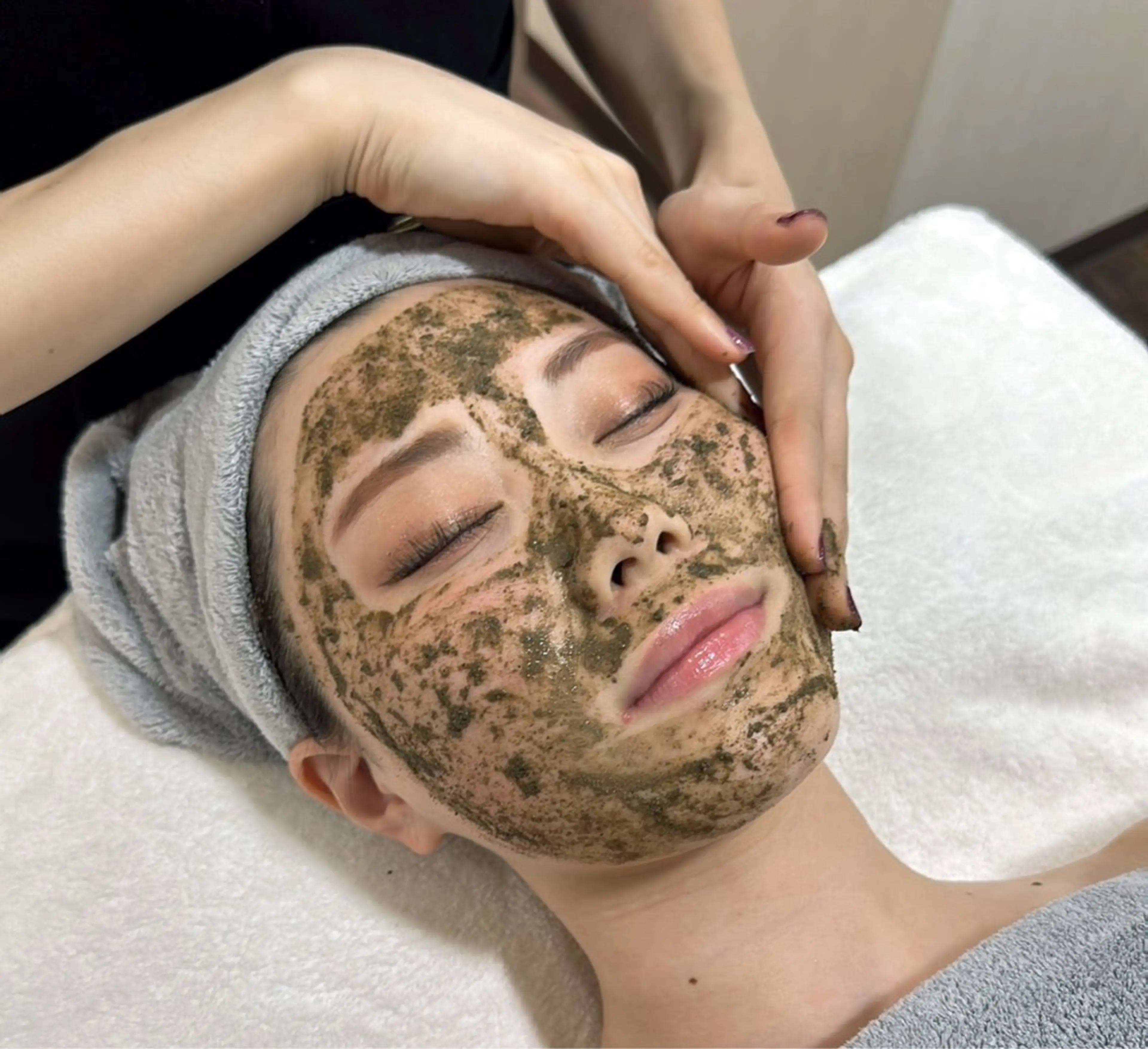 no.1✨毛穴悩み・肌荒れ・ニキビ痕にも効果的✨【天然100%ハーブトリートメント🌿】の写真