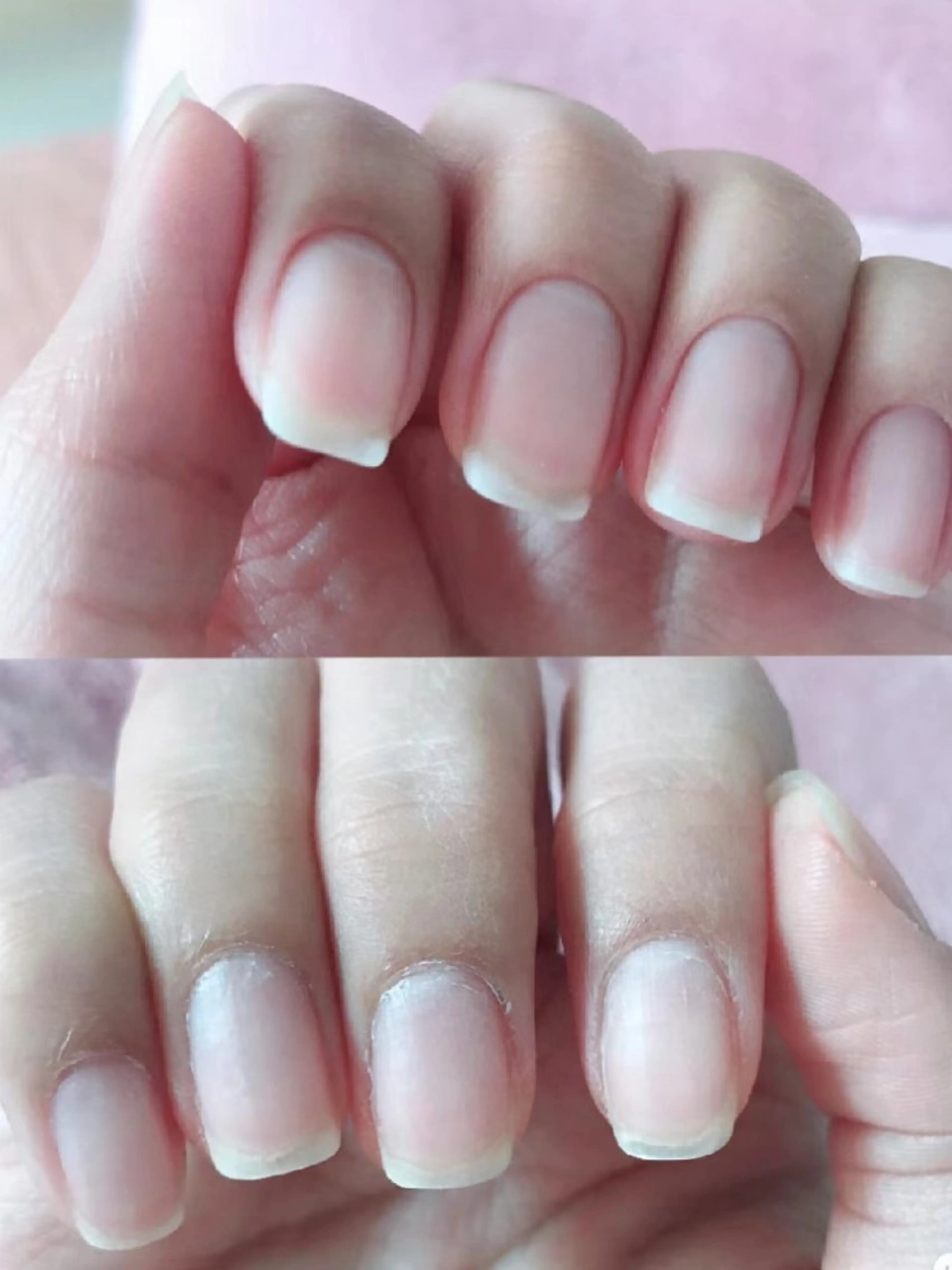 ネイル ネイリストゆか💅 長さだし、深爪矯正のネイルデザイン