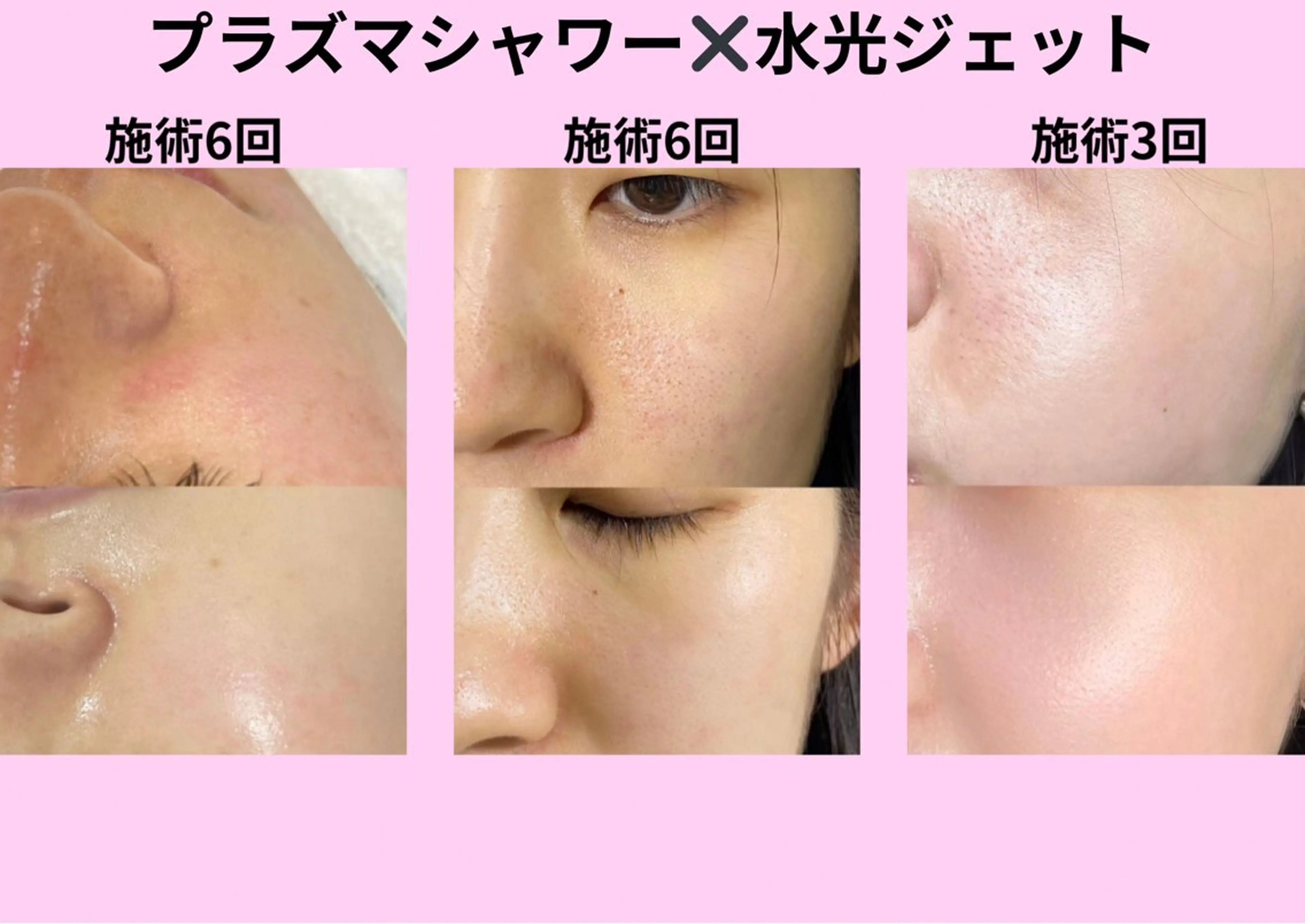 マツエク・マツパ エステ リラク 愛維美水光美肌専門店所属・愛維美水光美肌専門店 メンズレディースokのエステ・リラクイメージ