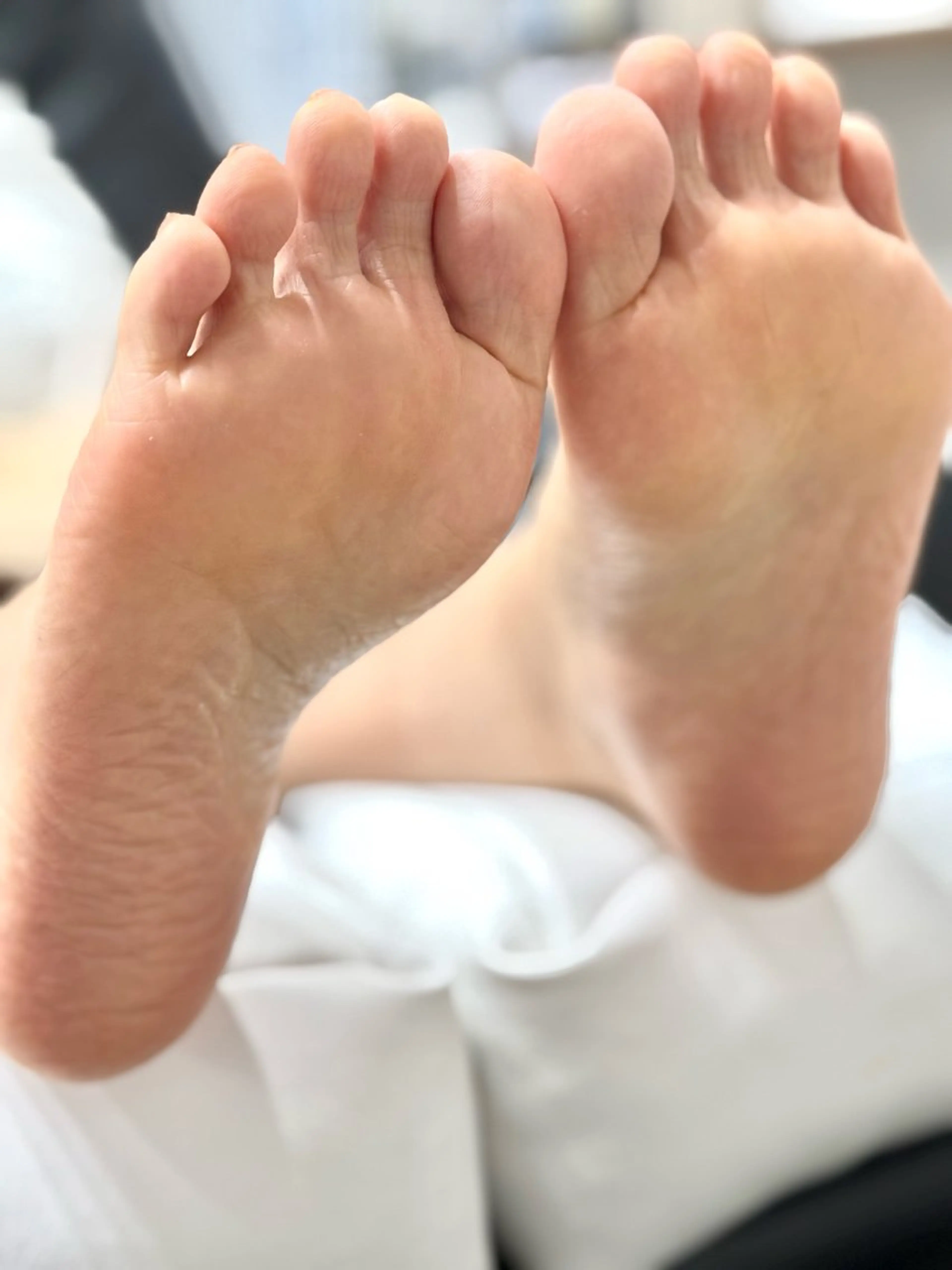 角質ケアの写真