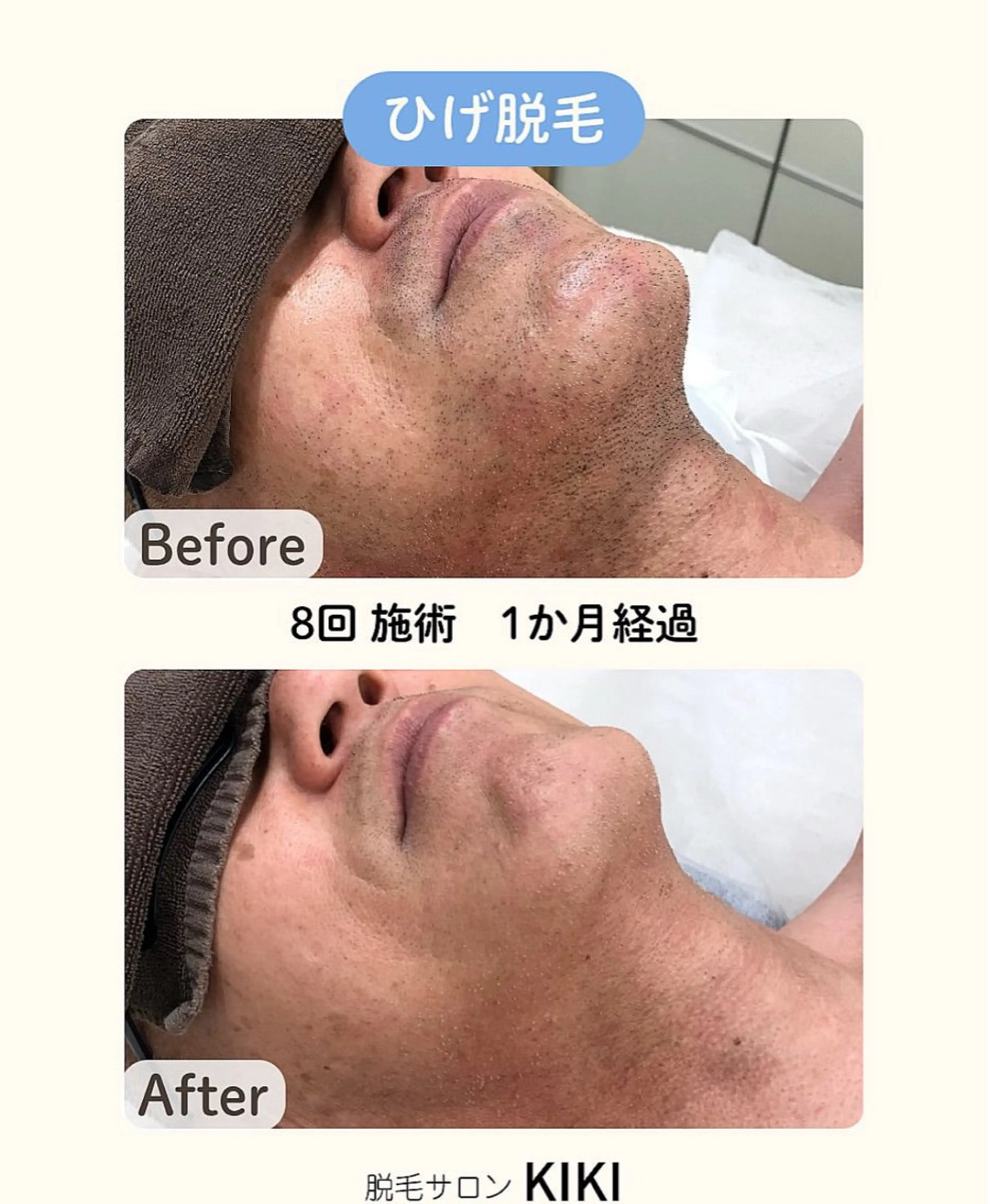 脱毛サロンKIKI所属・脱毛サロンKIKI みゆのエステ・リラクイメージ