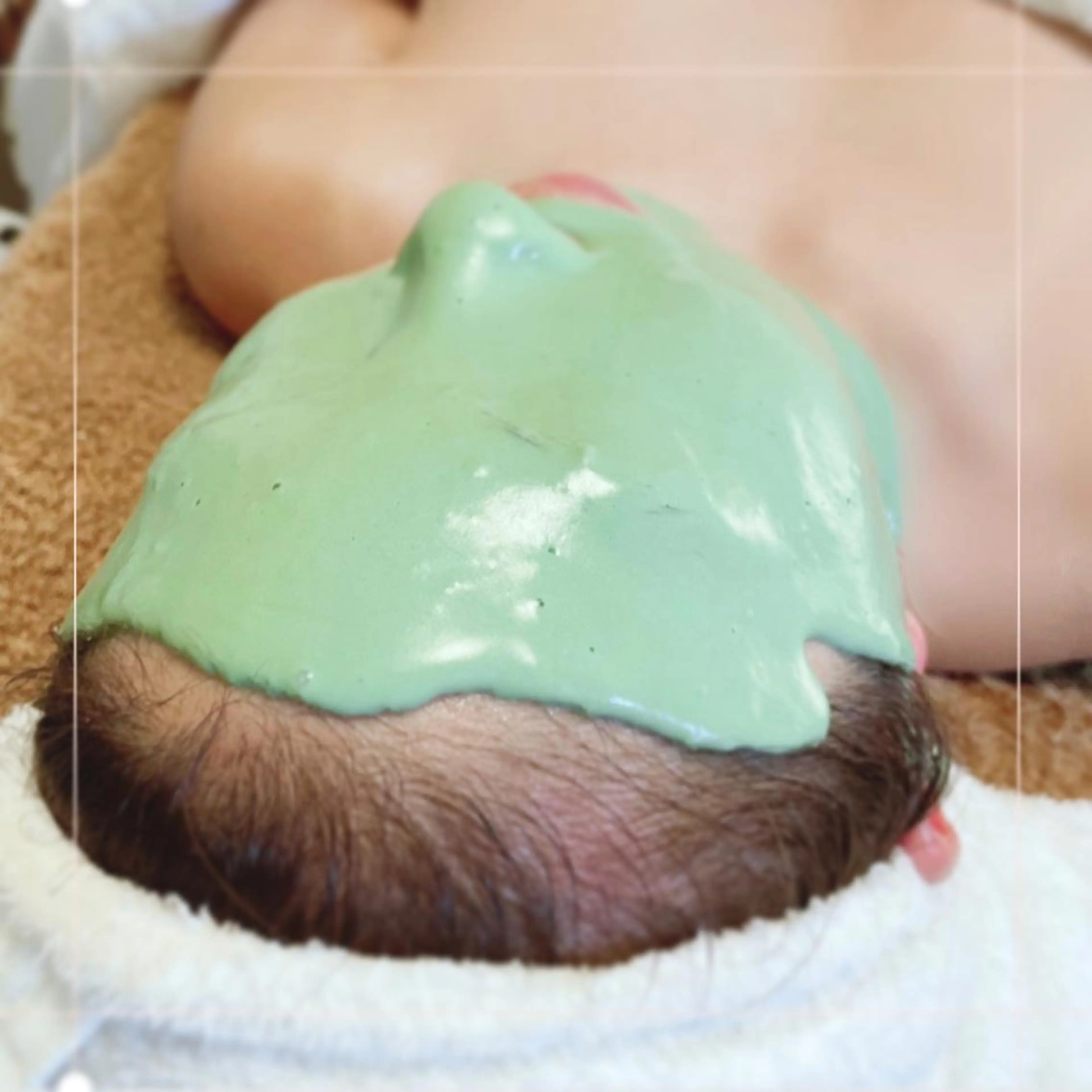 【人気No.2】ニキビ&お肌の赤みが気になる方に✨✨アドバンスコース50分＋ビューネケアパックの写真