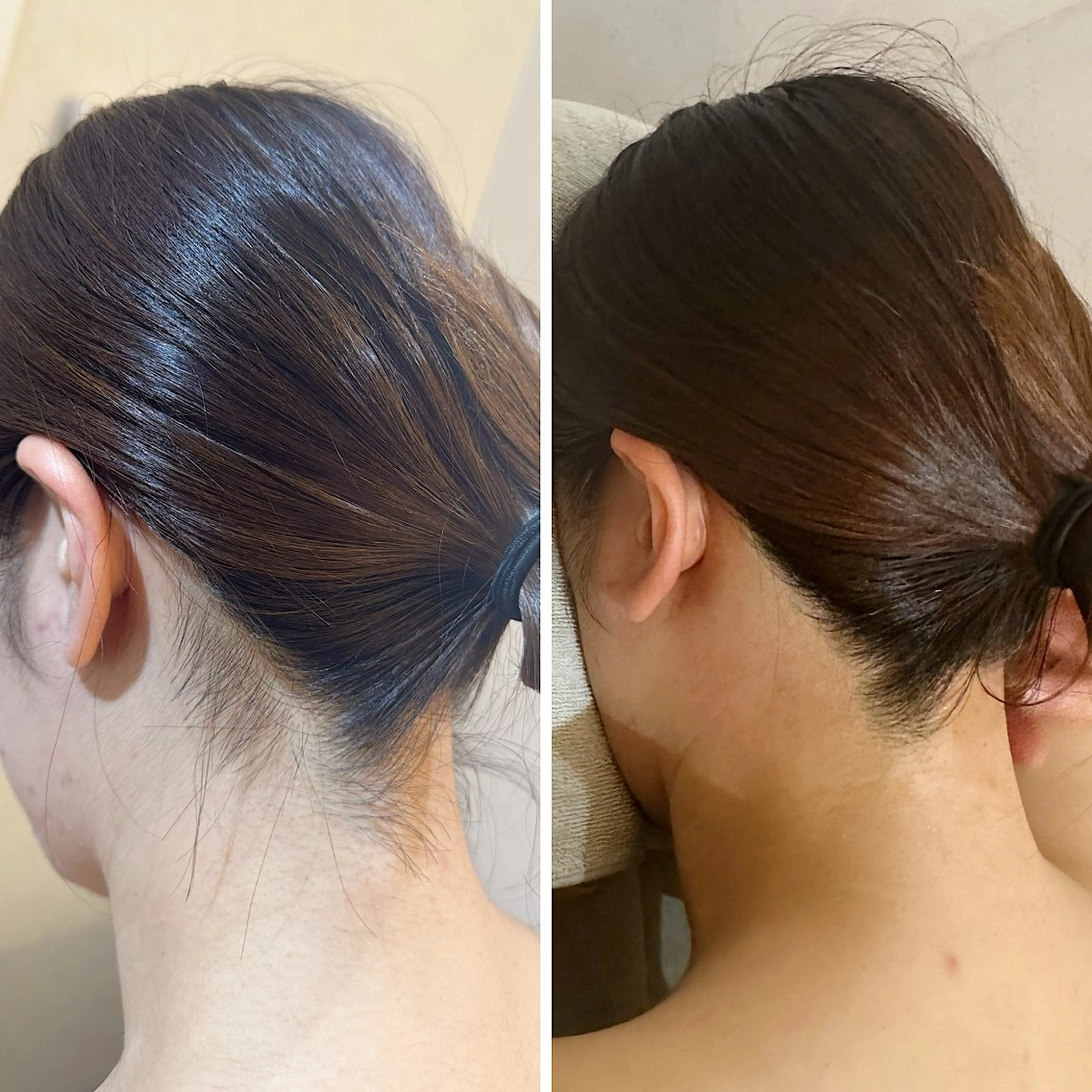 脱毛 うなじ脱毛/美肌脱毛 LABELのエステ・リラクイメージ