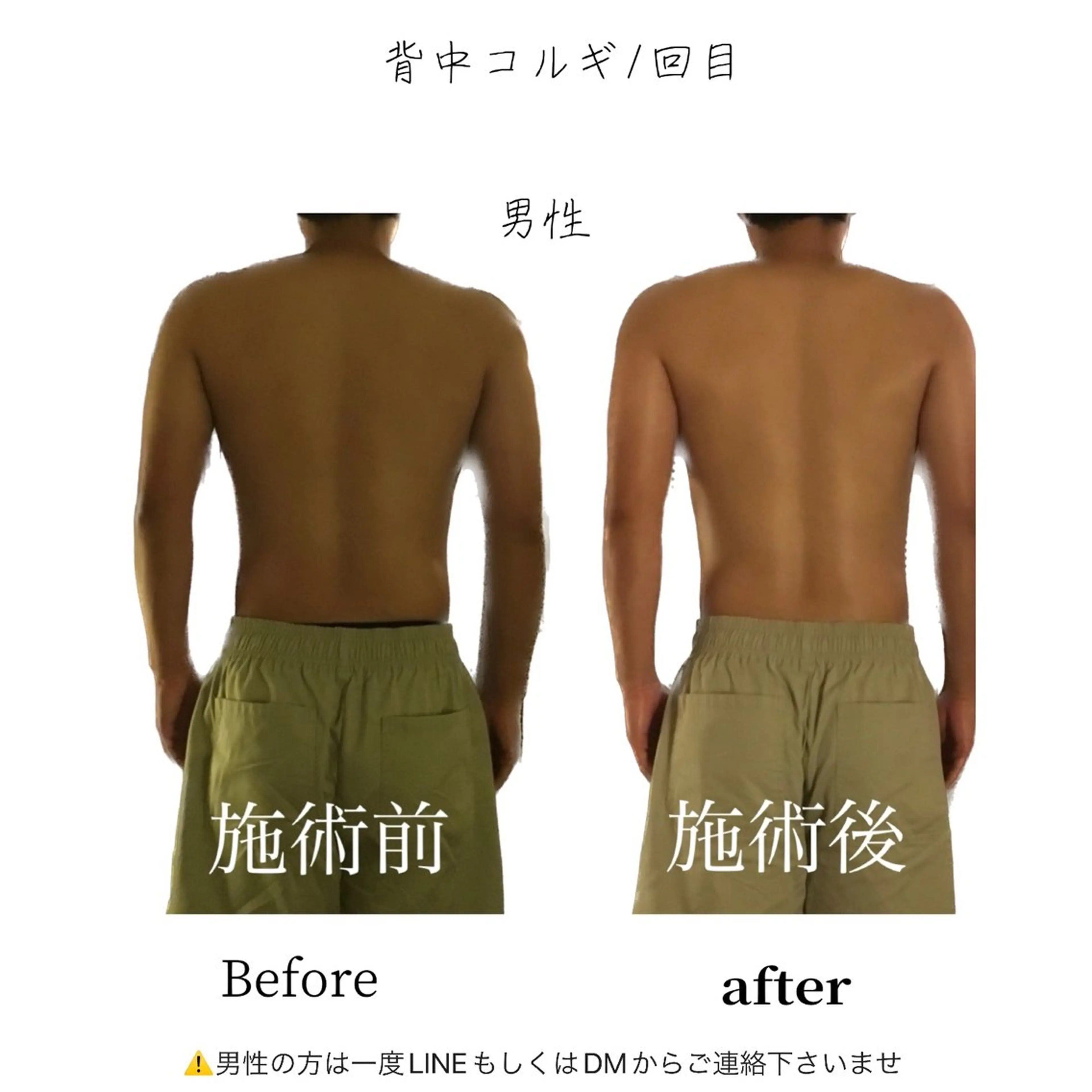 エステ リラク 小顔コルギ専門店/隠れ家サロン《여름ヨルム》所属・小顔コルギ専門店 《ヨルム》龍ケ崎店のエステ・リラクイメージ