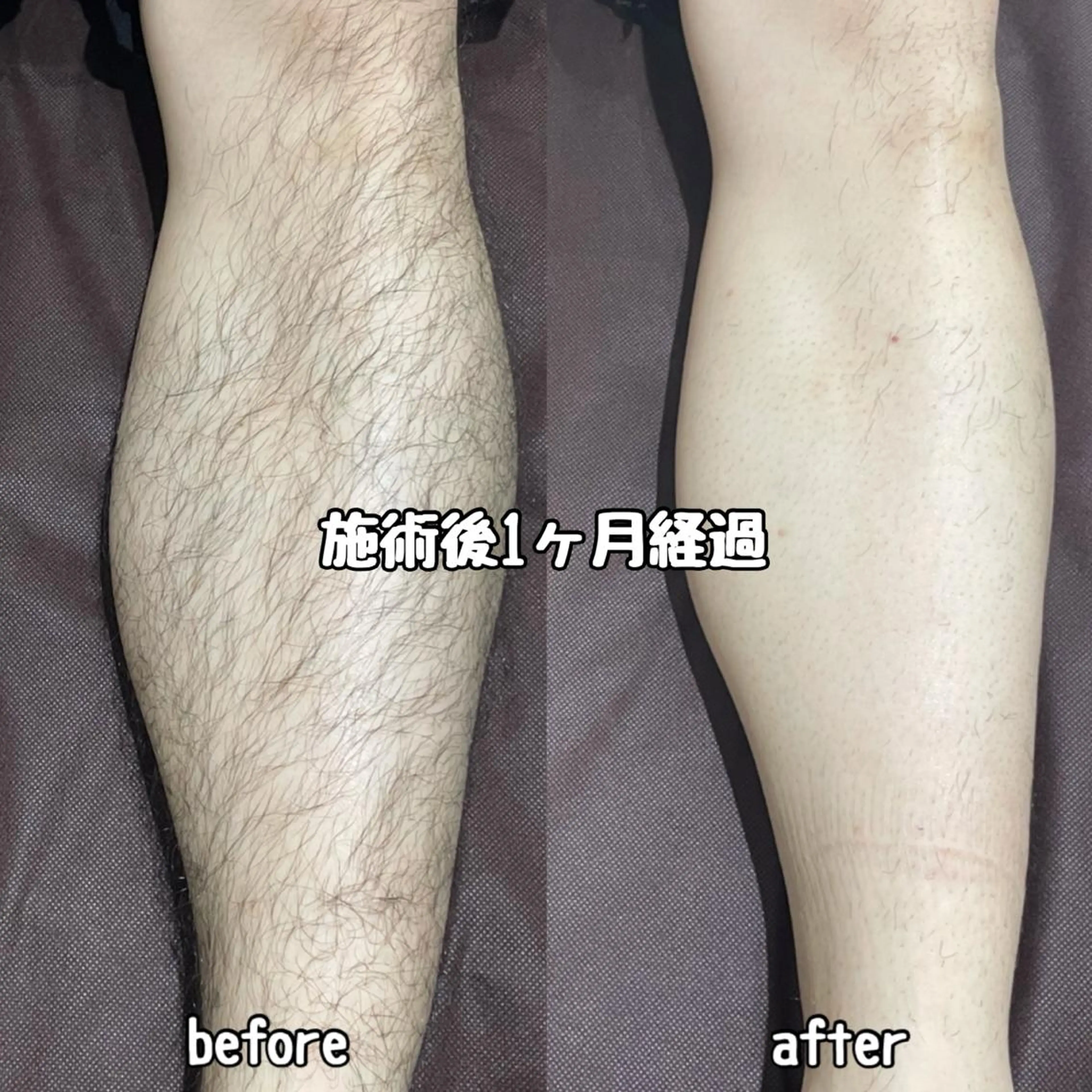 メンズ Diar salon もものエステ・リラクイメージ