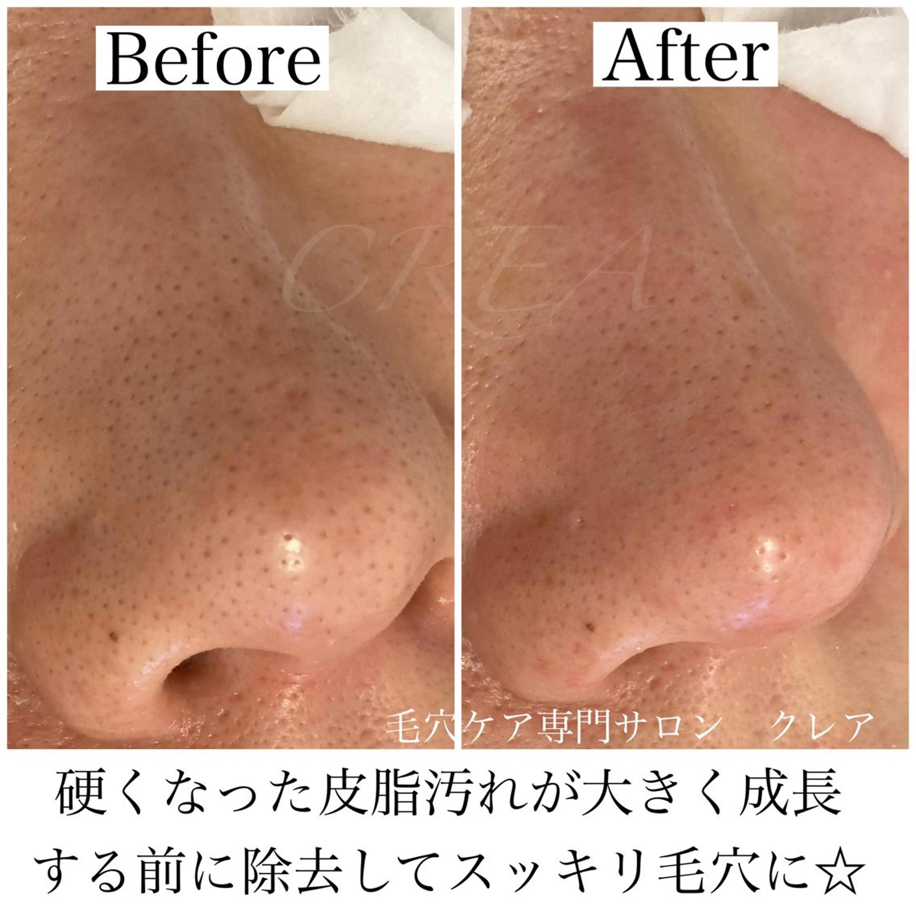 CREA【クレア】 川中のエステ・リラクイメージ