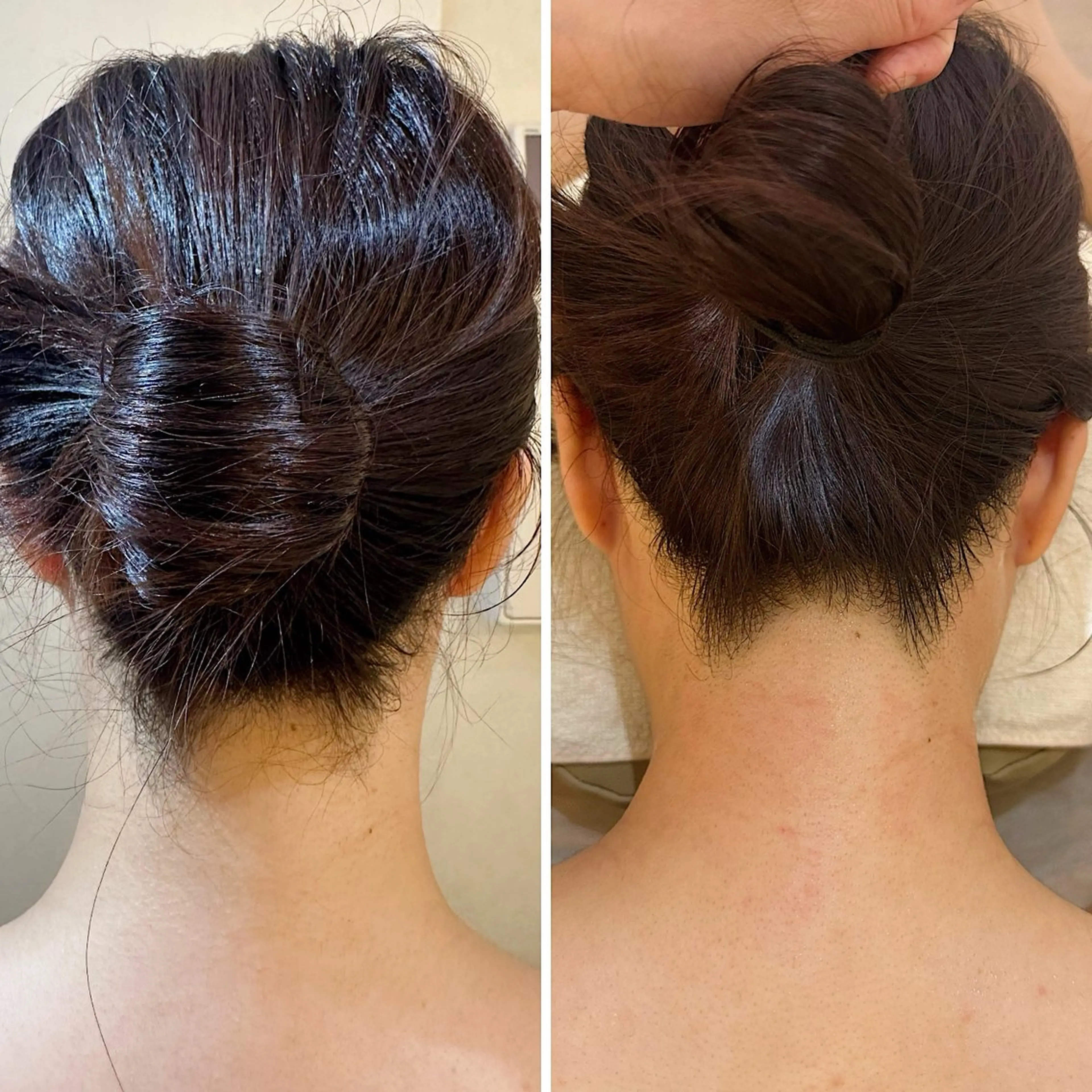 脱毛 うなじ脱毛/美肌脱毛 LABELのエステ・リラクイメージ