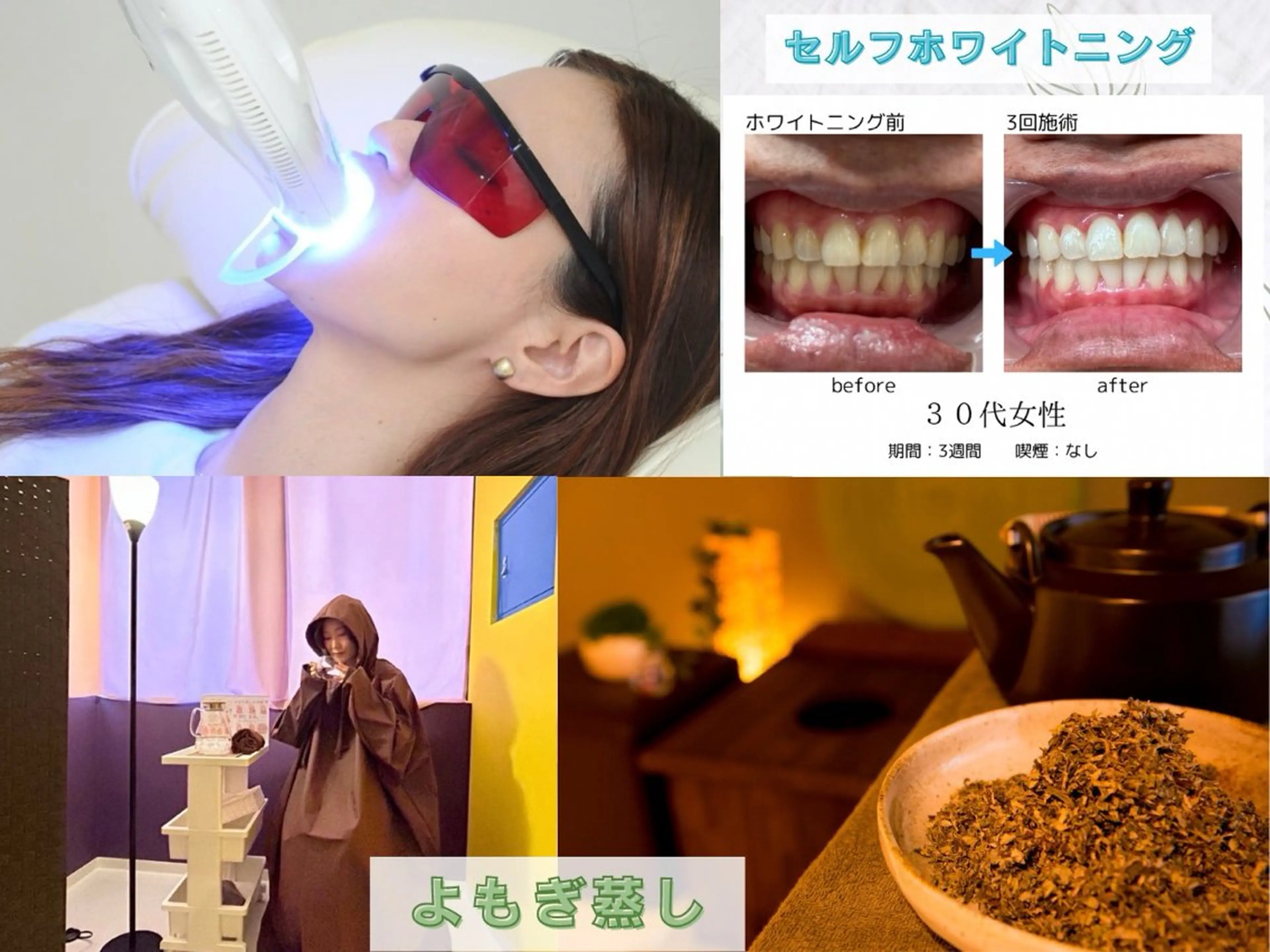 【3月限定】ホワイトニング&よもぎ蒸しセット20%OFF♪の写真