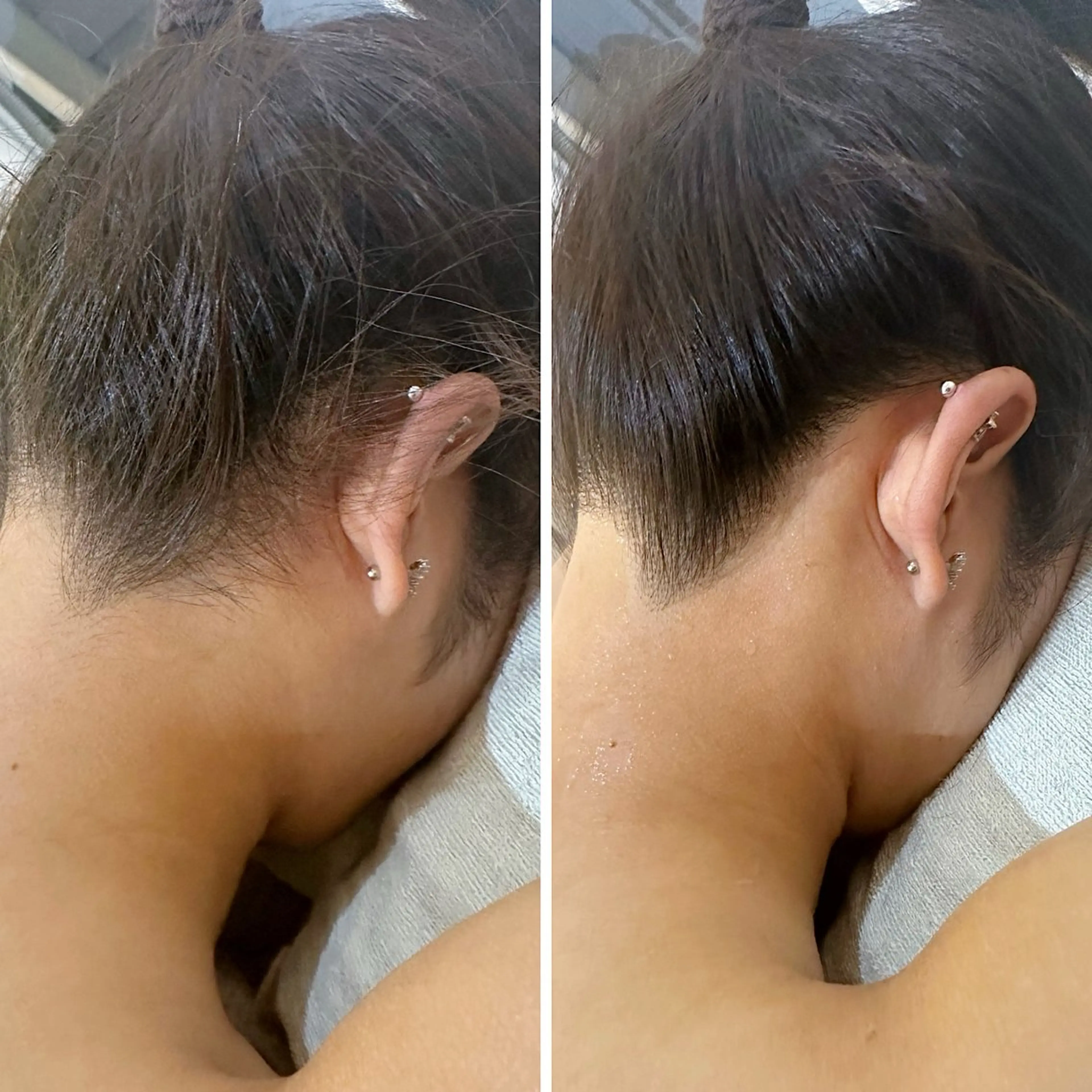 脱毛 うなじ脱毛/美肌脱毛 LABELのエステ・リラクイメージ