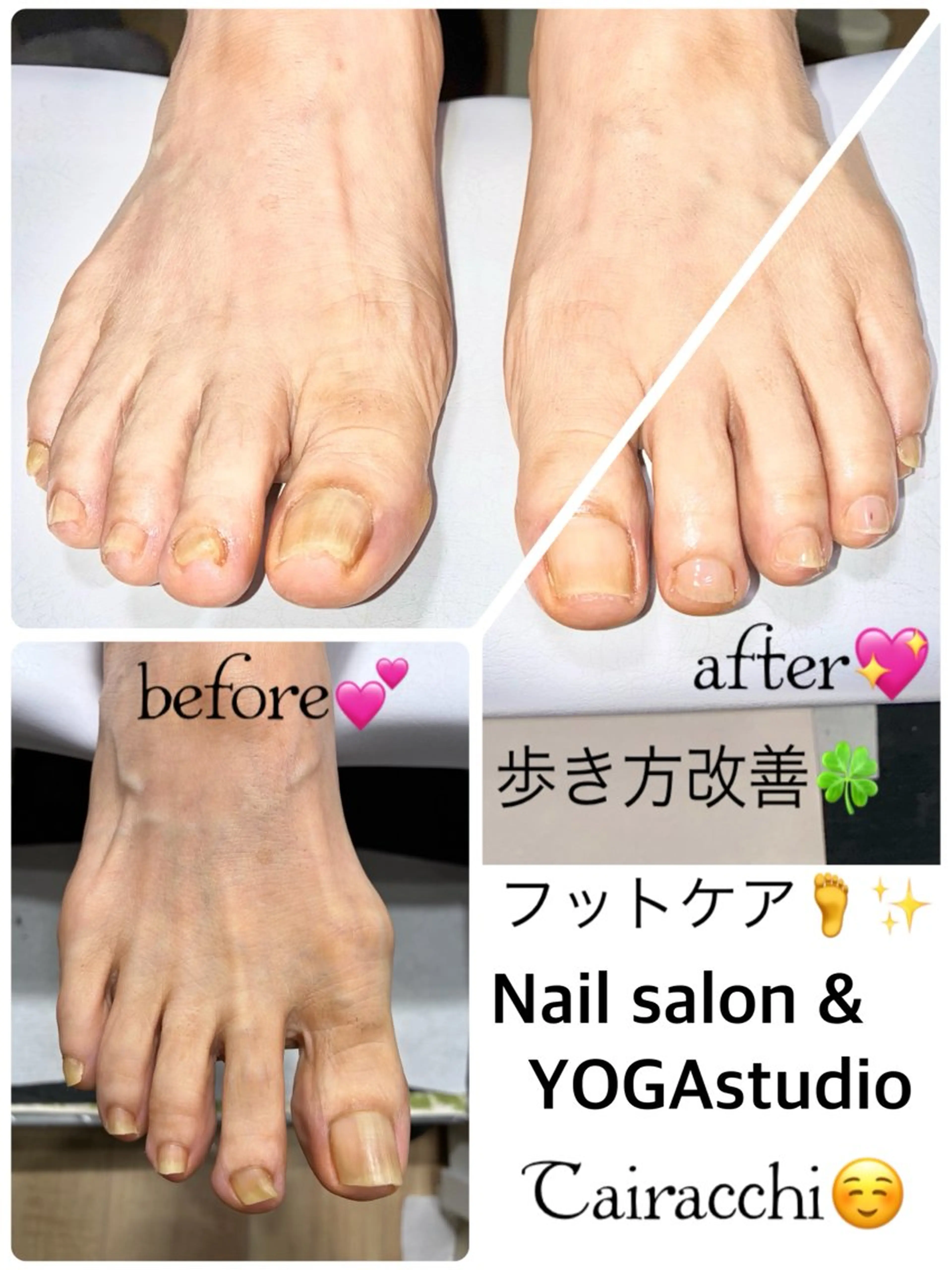 ネイル フットネイル フットネイル Tairacchi ﾀｲﾗｯﾁのネイルデザイン