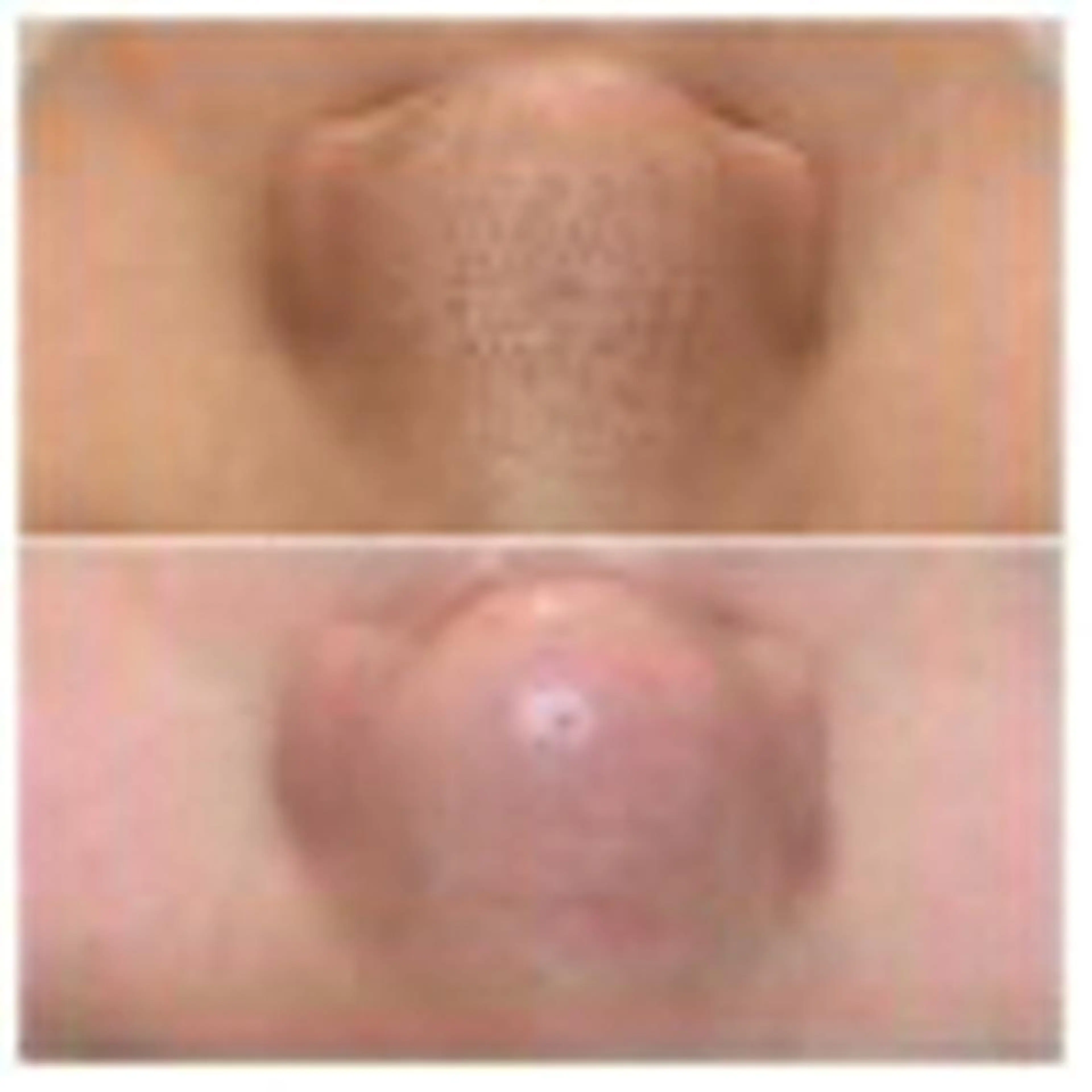 【✨美肌メニュー✨】全員🙆♀️🙆♂️毛穴洗浄✖️美眉ワックス+骨格診断の写真