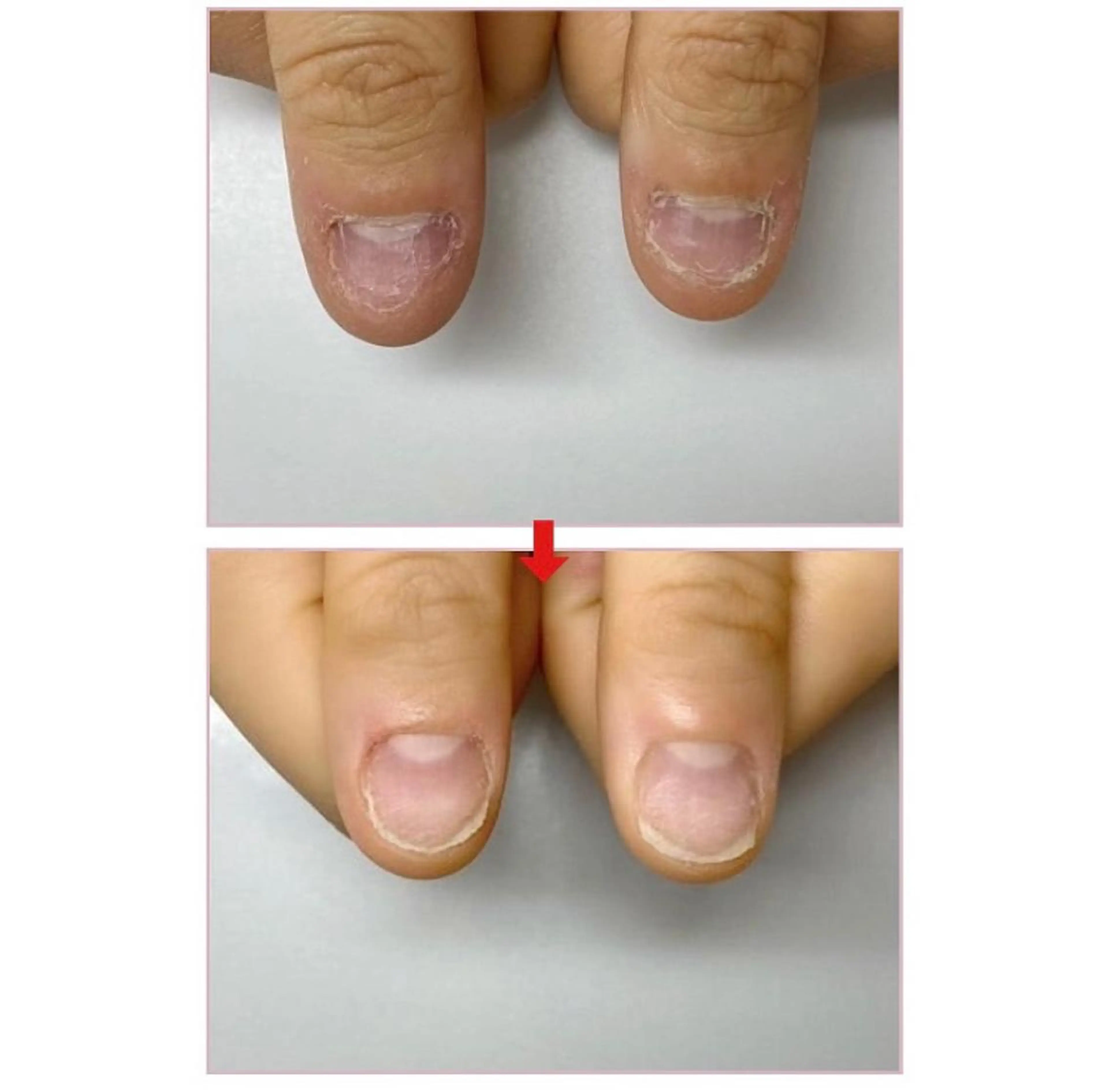 ネイル ネイルサロンアリューム所属・ネイルサロン アリュームのネイルデザイン