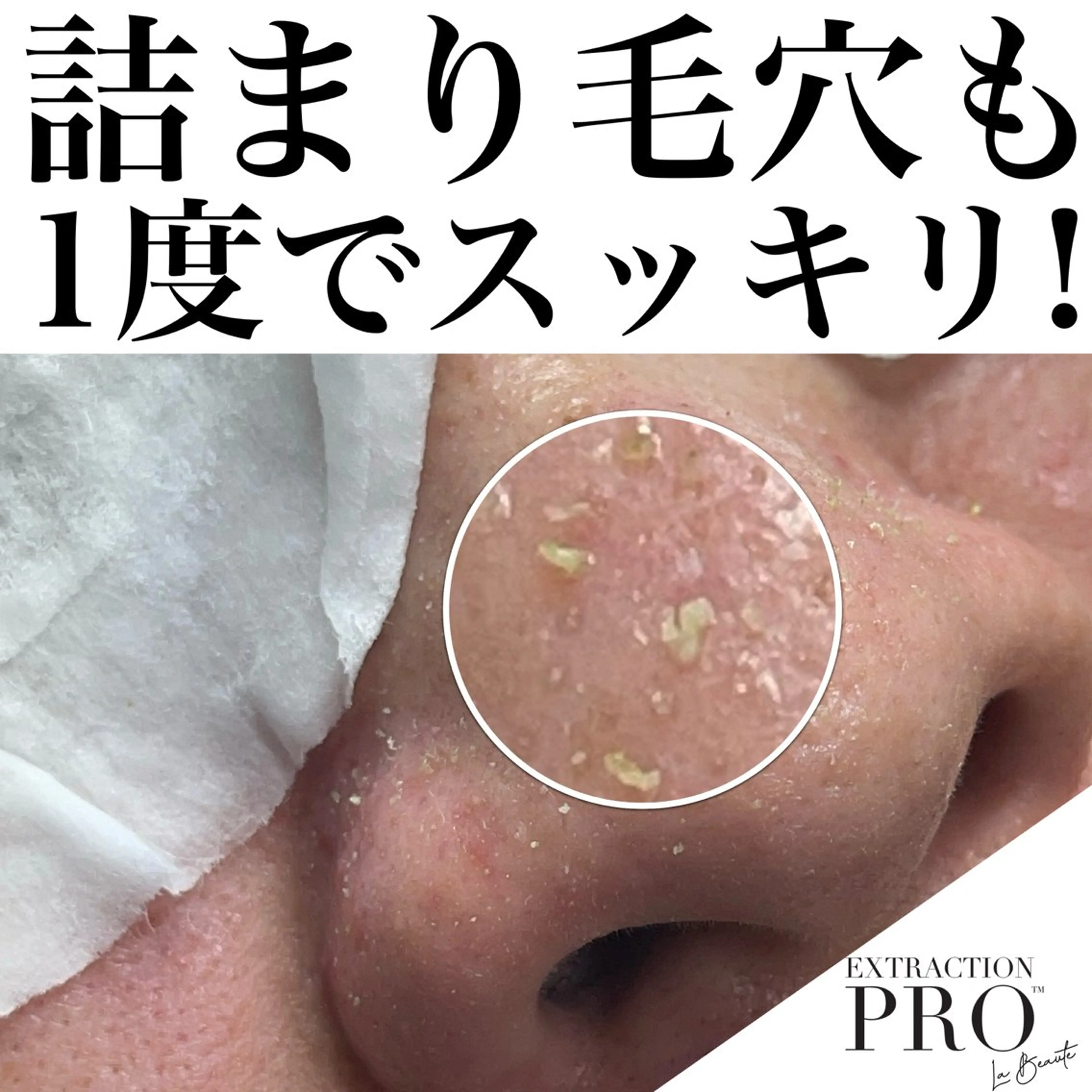 【詰まり毛穴洗浄】今話題のエクストラクションで肌質改善◎とろけるフェイシャルマッサージ＆生パック　南森町駅から徒歩5分✨の写真