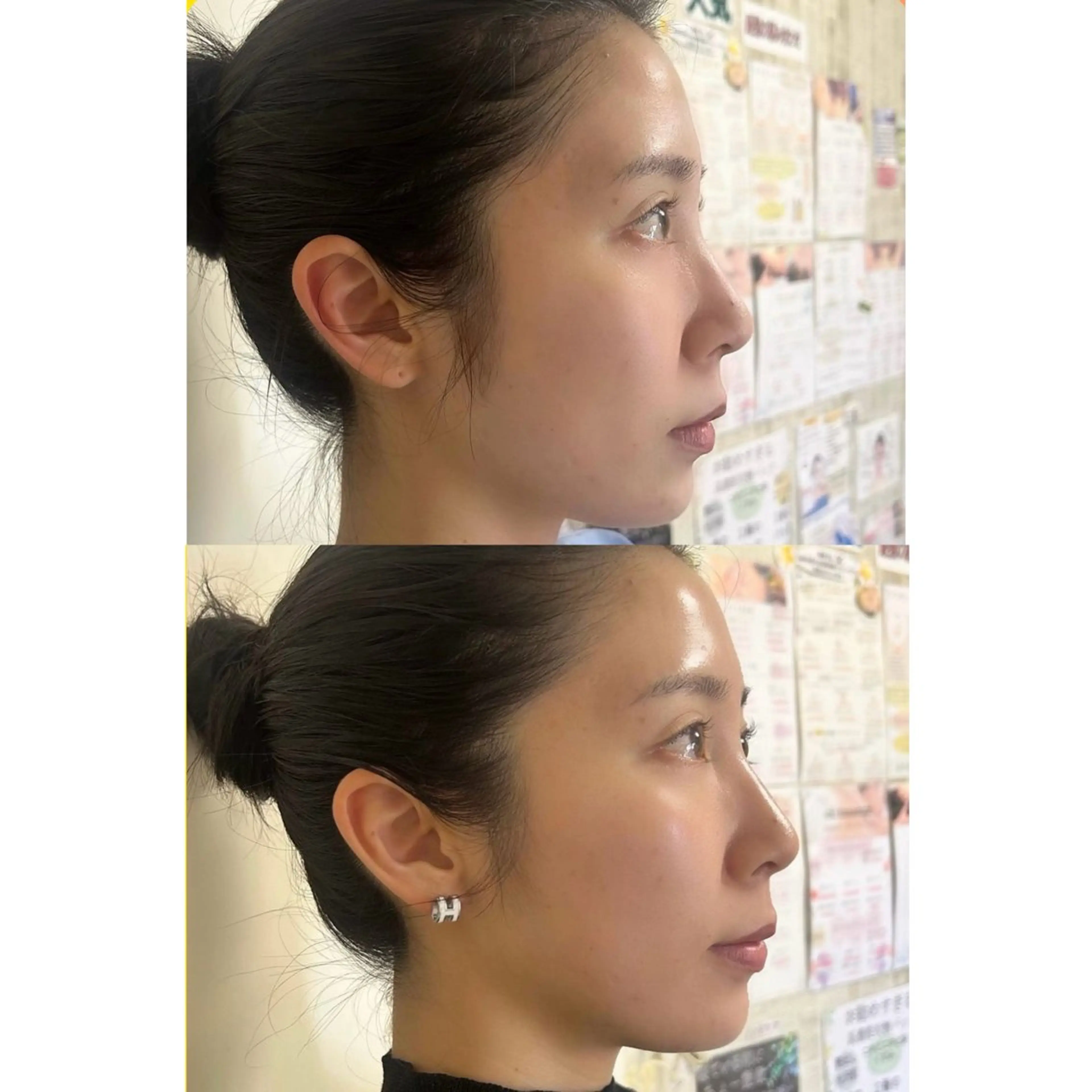 エステ リラク 美容鍼灸サロン mahoroba院長のエステ・リラクイメージ