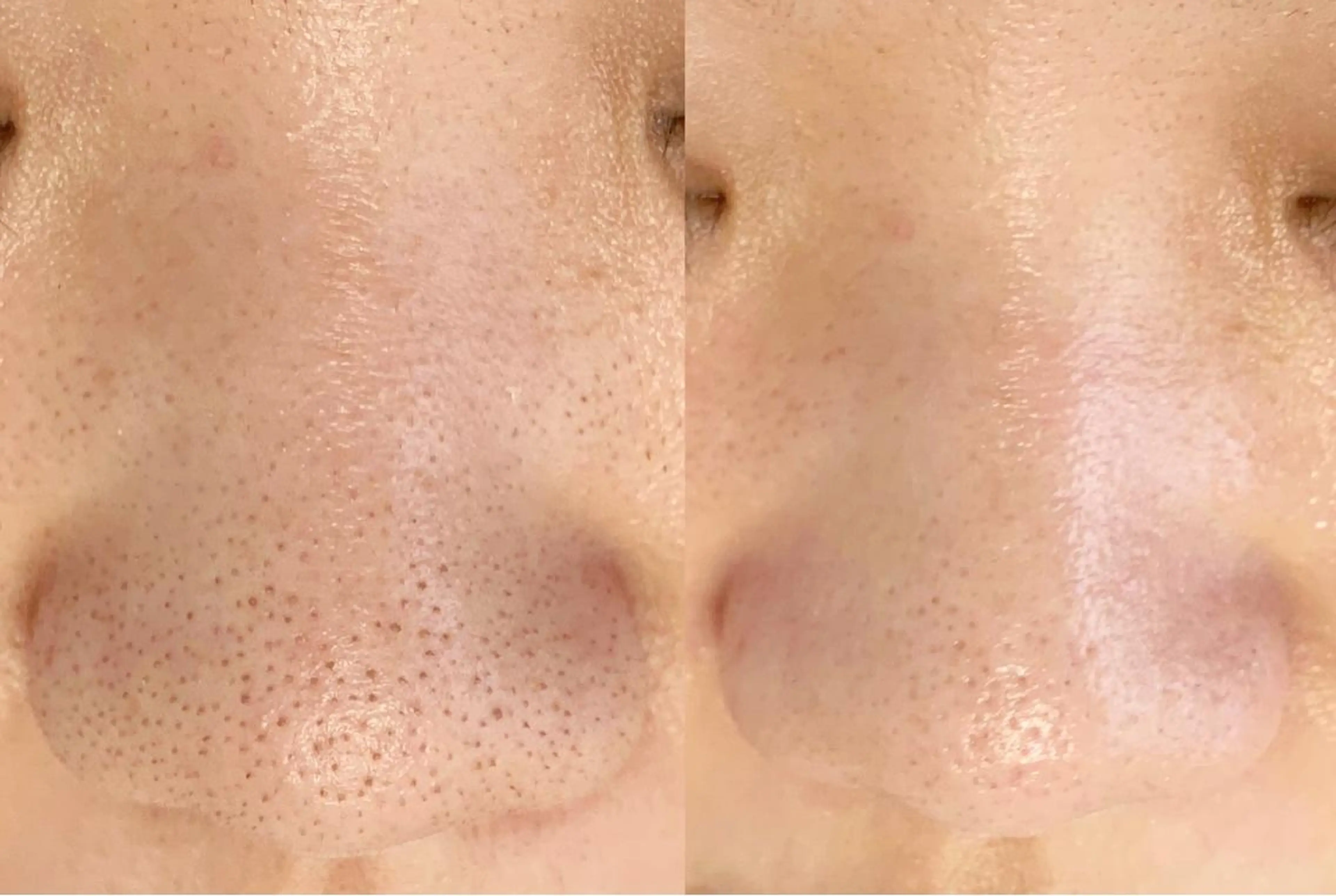 メンズ エステ salonLADYSTYLE所属・稲嶺 美華のエステ・リラクイメージ