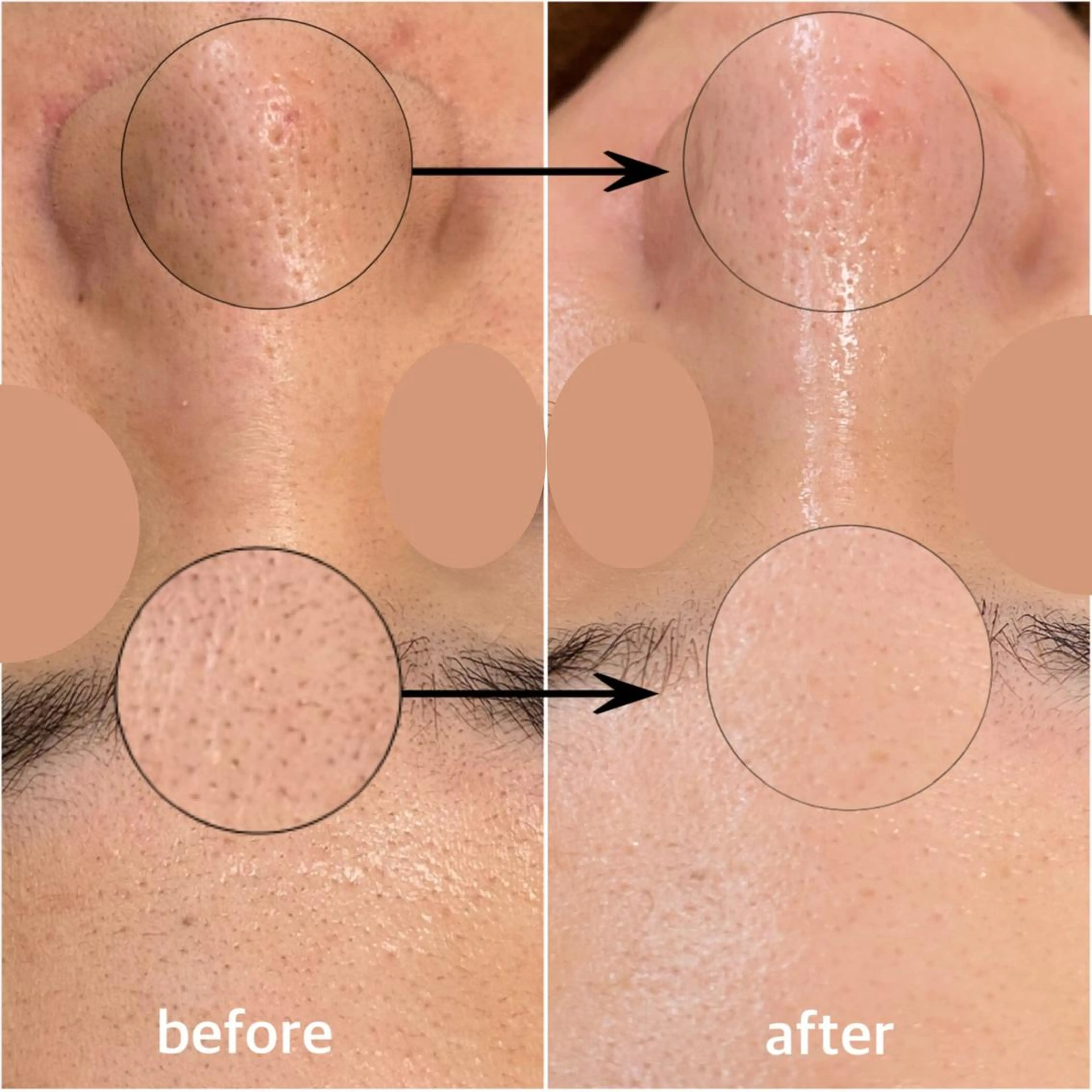 韓国肌管理 【毛穴専科】のエステ・リラクイメージ