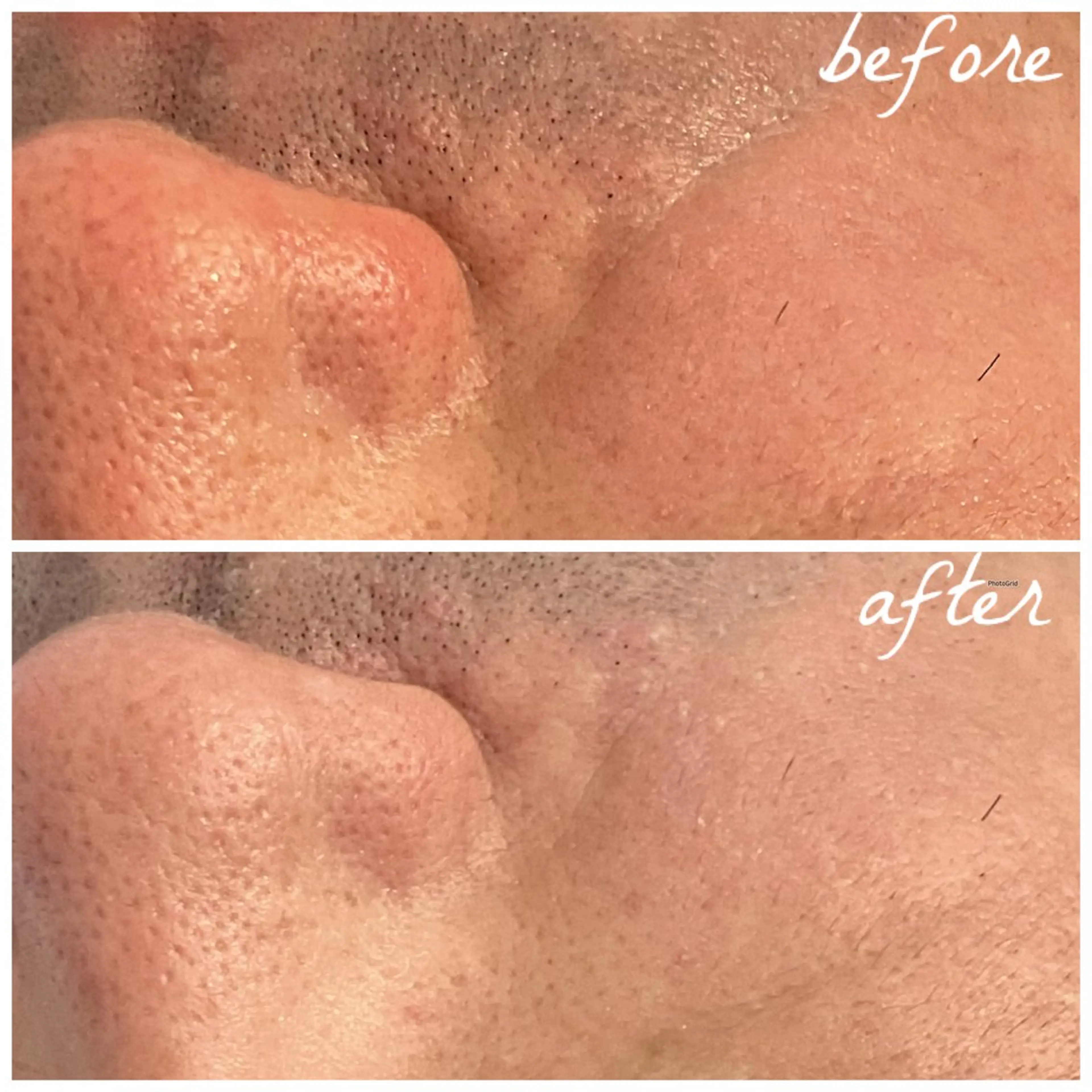 メンズ エステ メナード岐阜茜部 杉浦のエステ・リラクイメージ